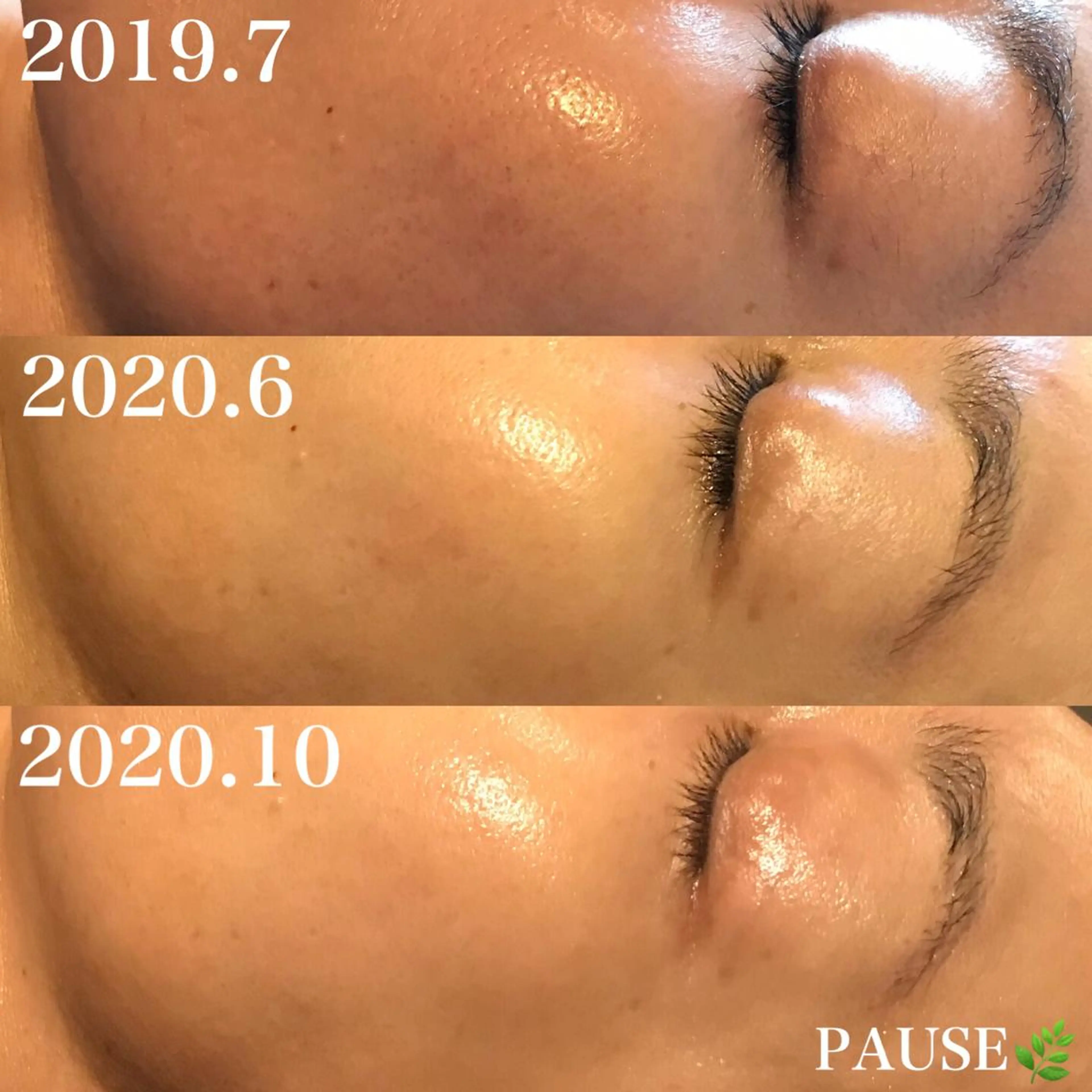 エステ 浜野 恵美のエステ・リラクイメージ