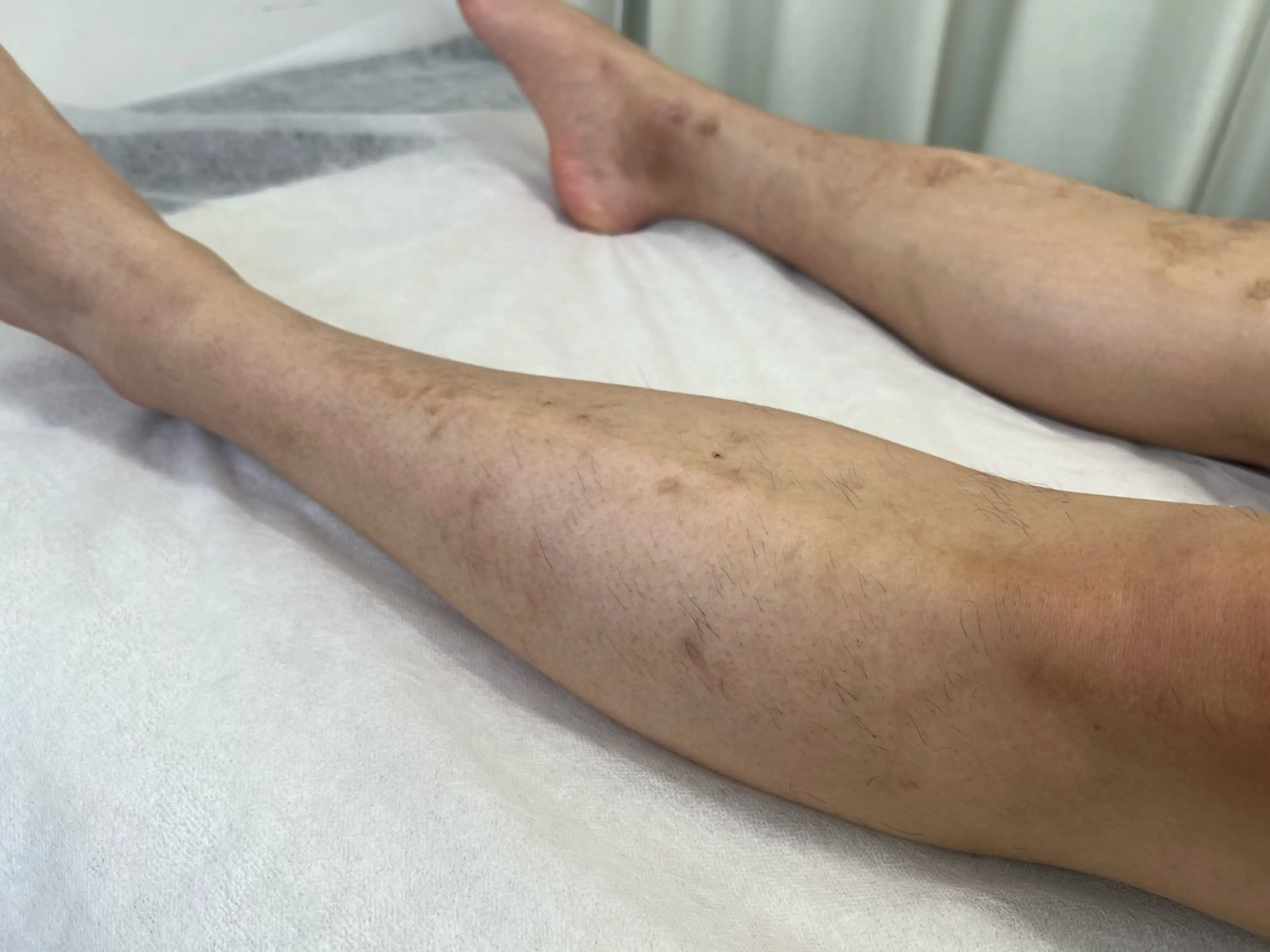 メンズ 脱毛 瀬戸 梨子のエステ・リラクイメージ