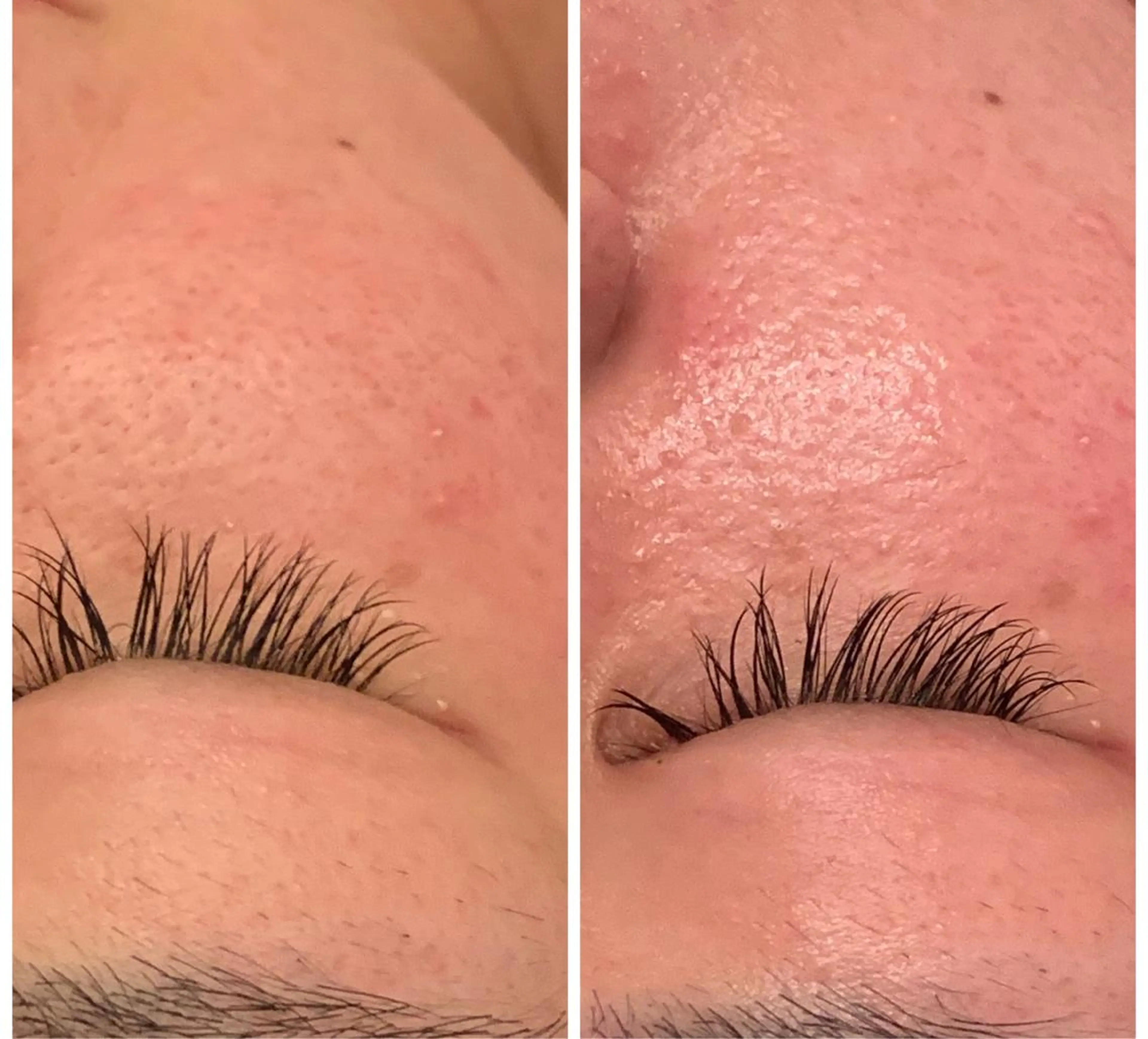 食べながら魅せボディ éclatJua川越のエステ・リラクイメージ