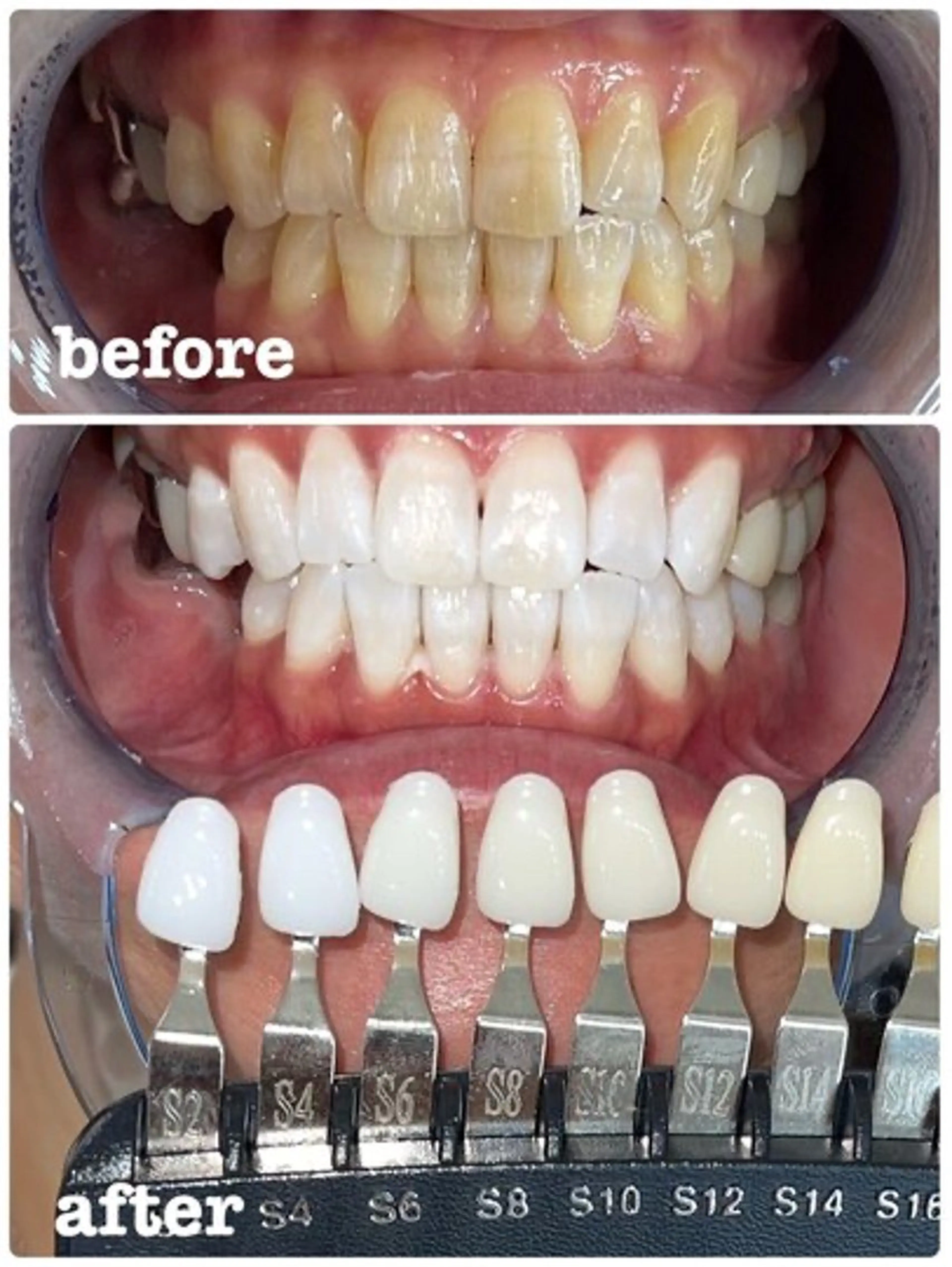 エクシア ホワイトニング西条店のその他イメージ