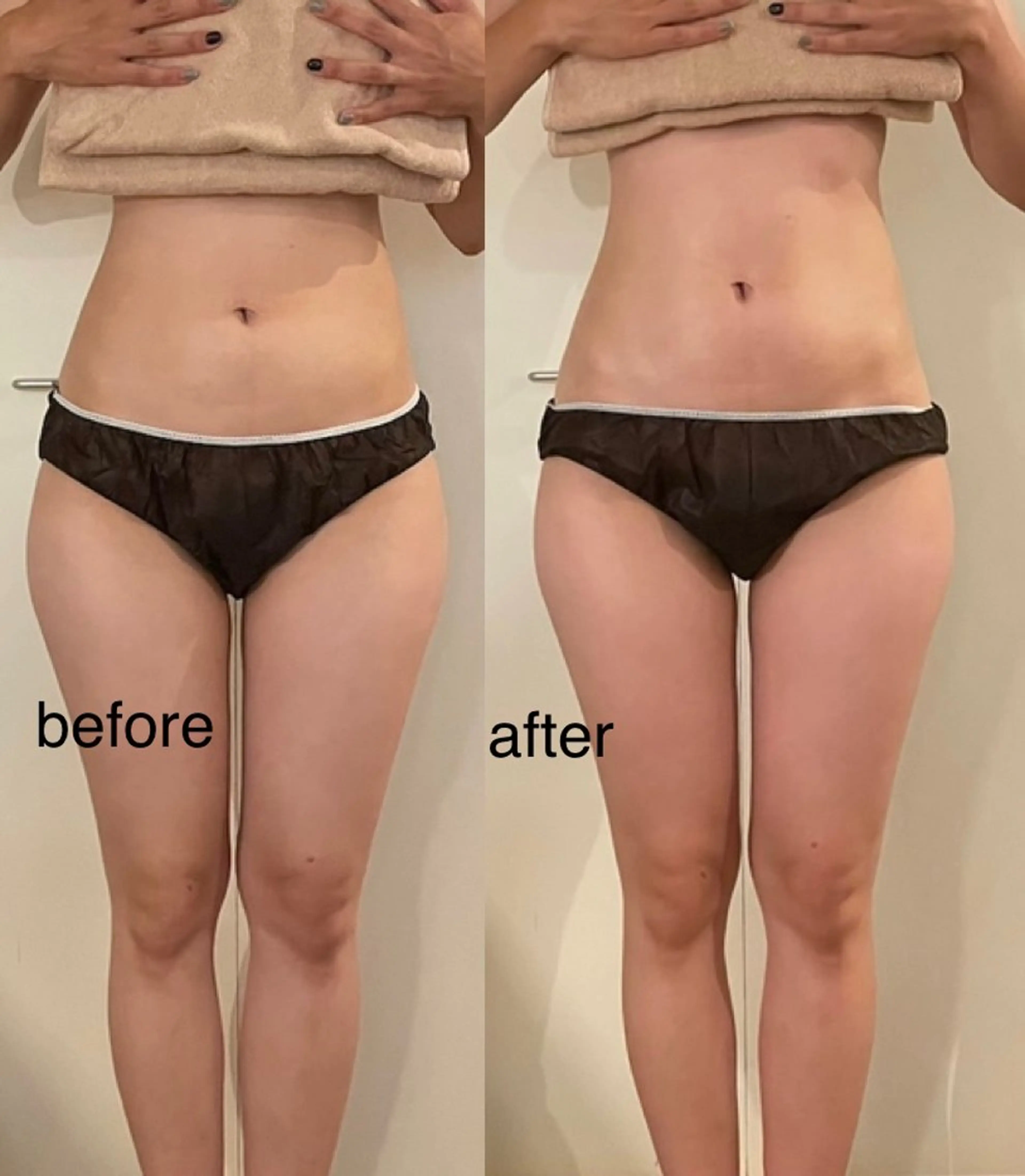 エステ リラク プライベートサロン シュシュのエステ・リラクイメージ