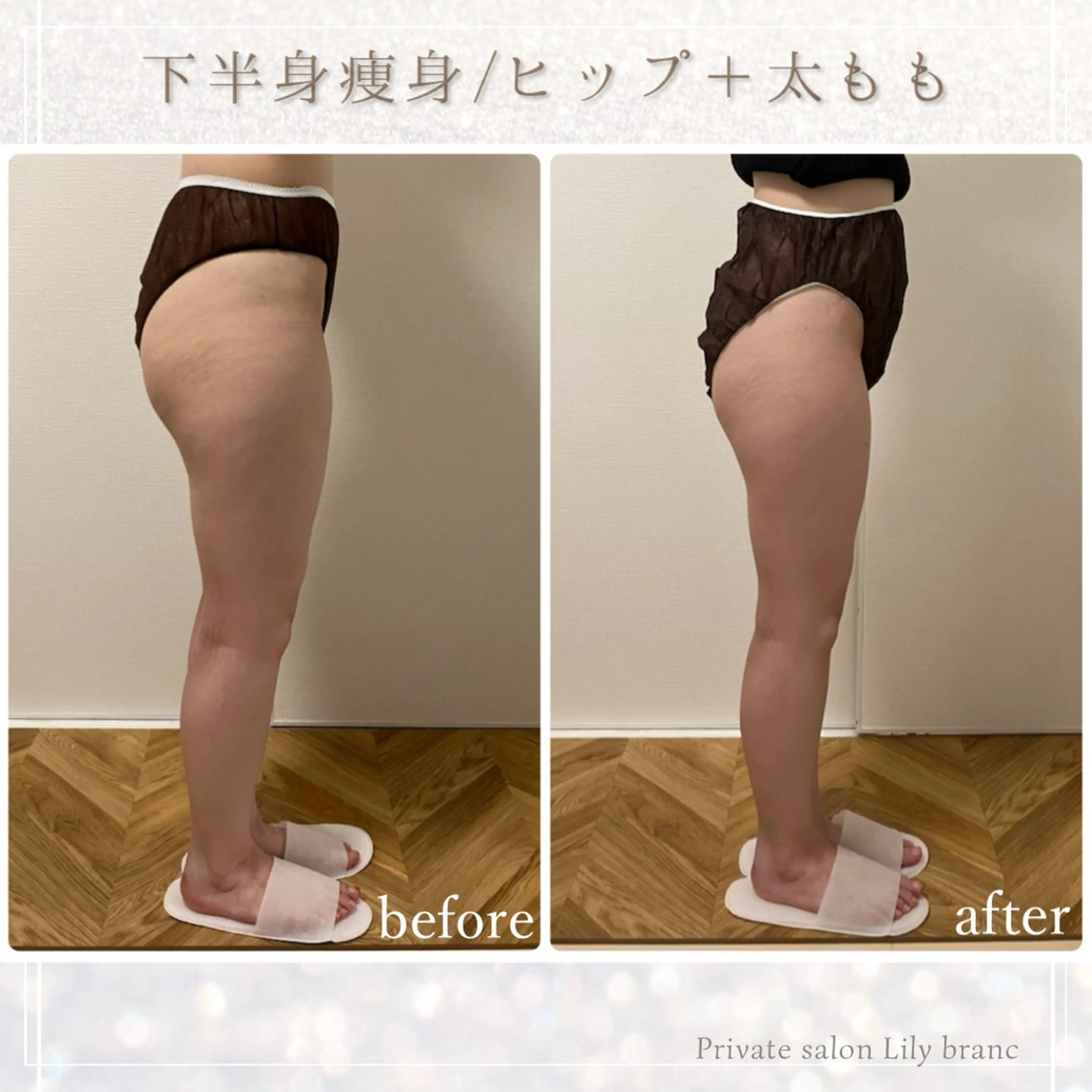 エステ Lily branc 痩身/小顔/肌質改善のエステ・リラクイメージ