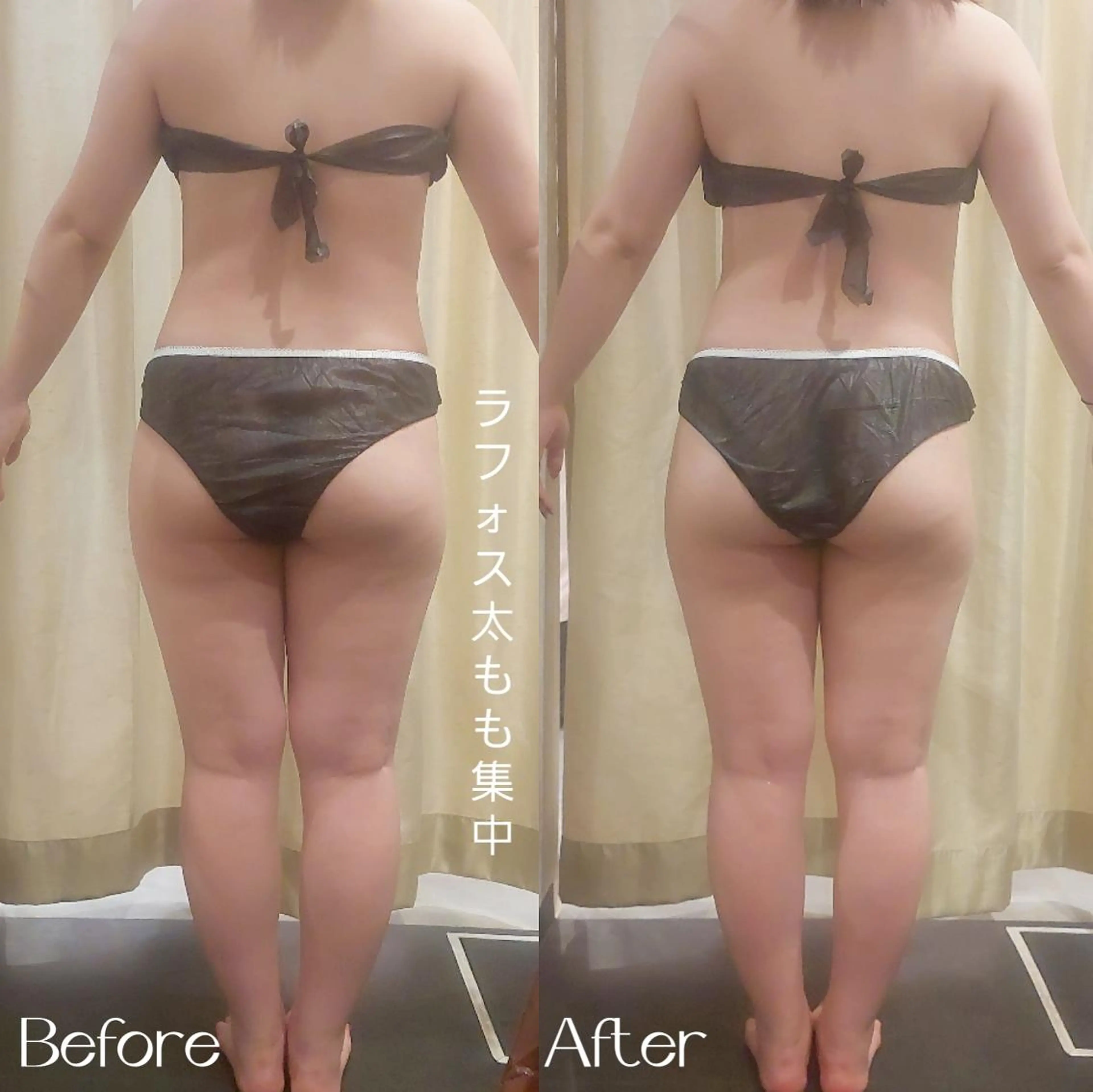 エステ リラク MyFairLady miuのエステ・リラクイメージ