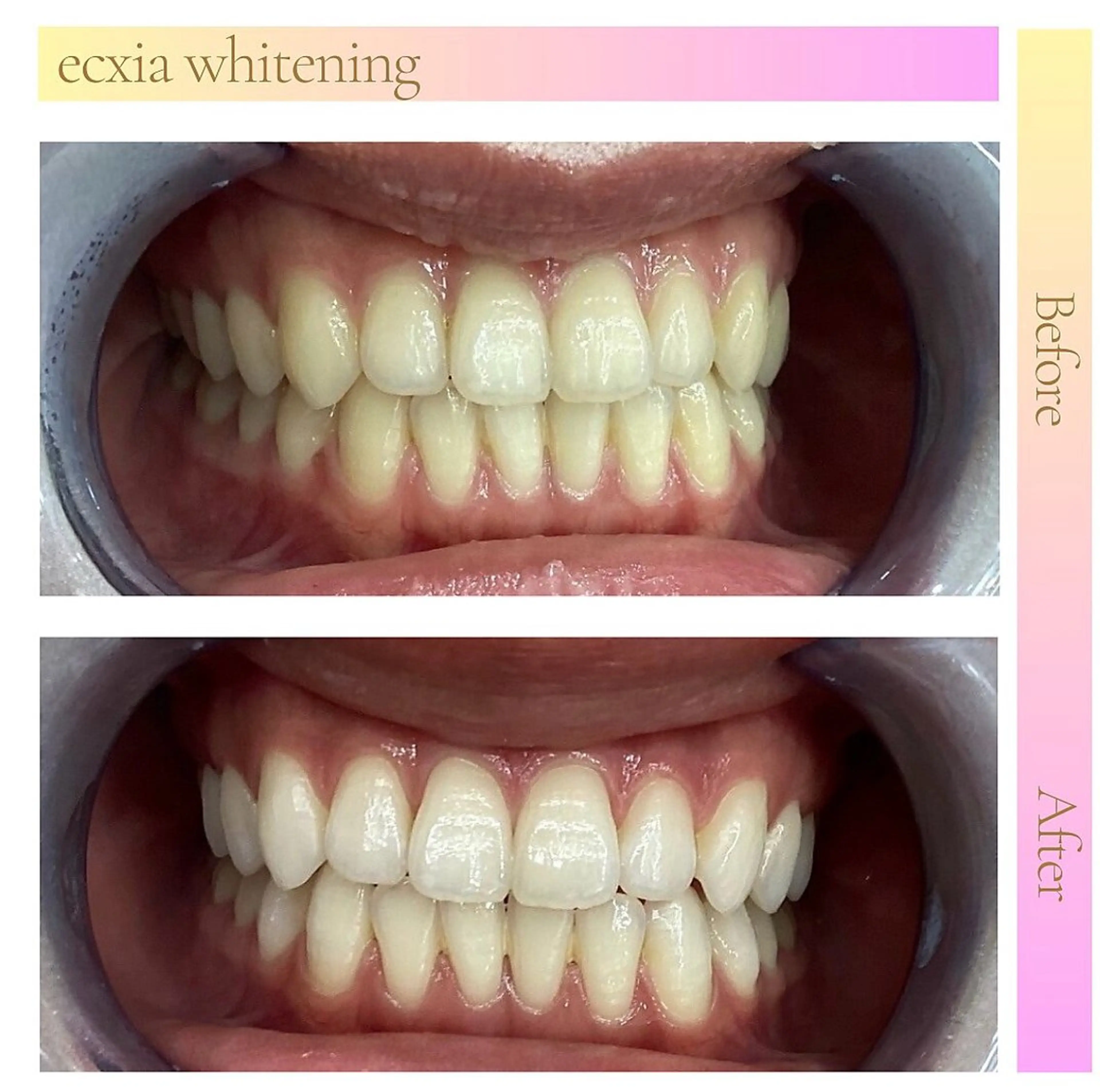 エクシアホワイト 💟fukaのその他イメージ