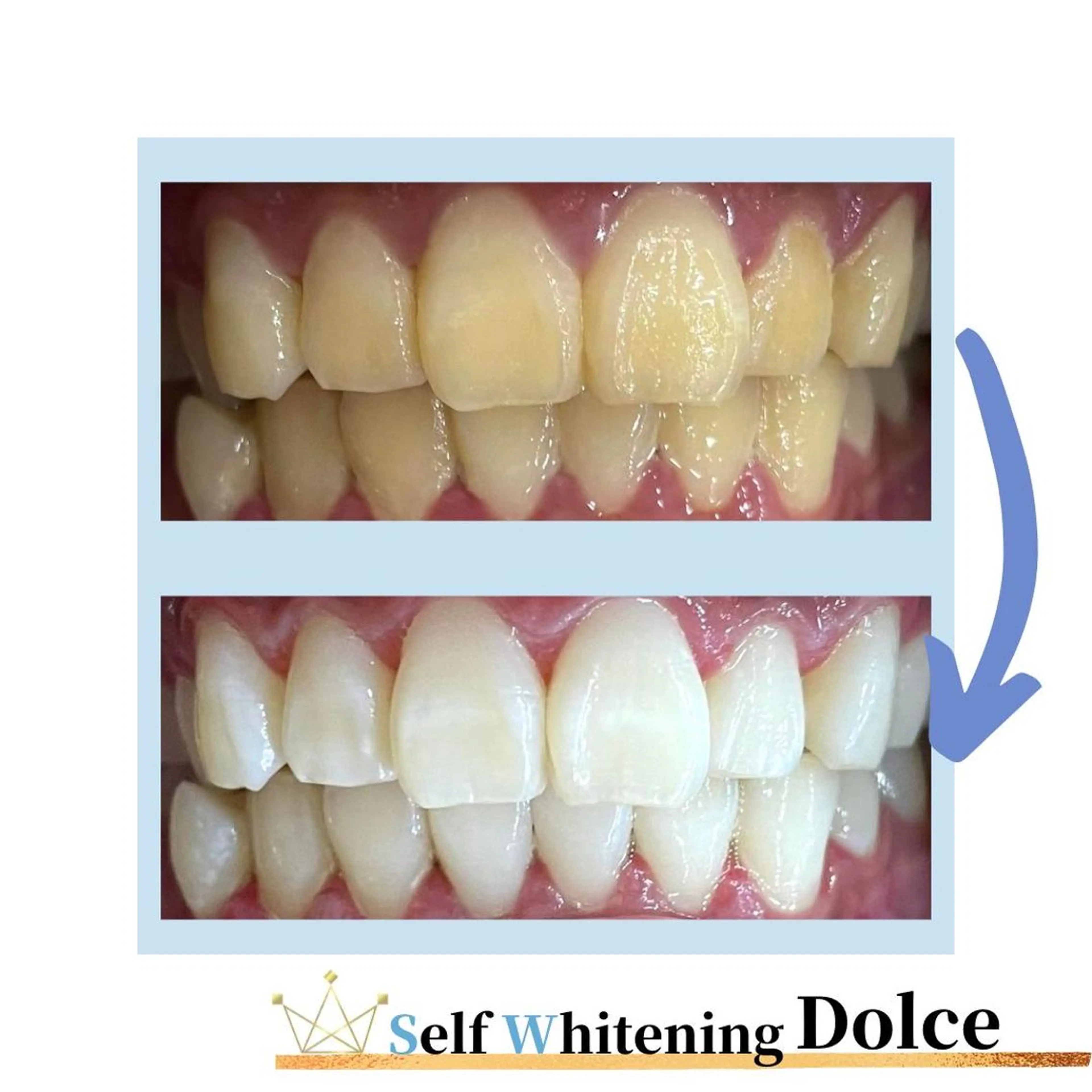 その他 セルフホワイトニング Dolce八王子店のその他イメージ