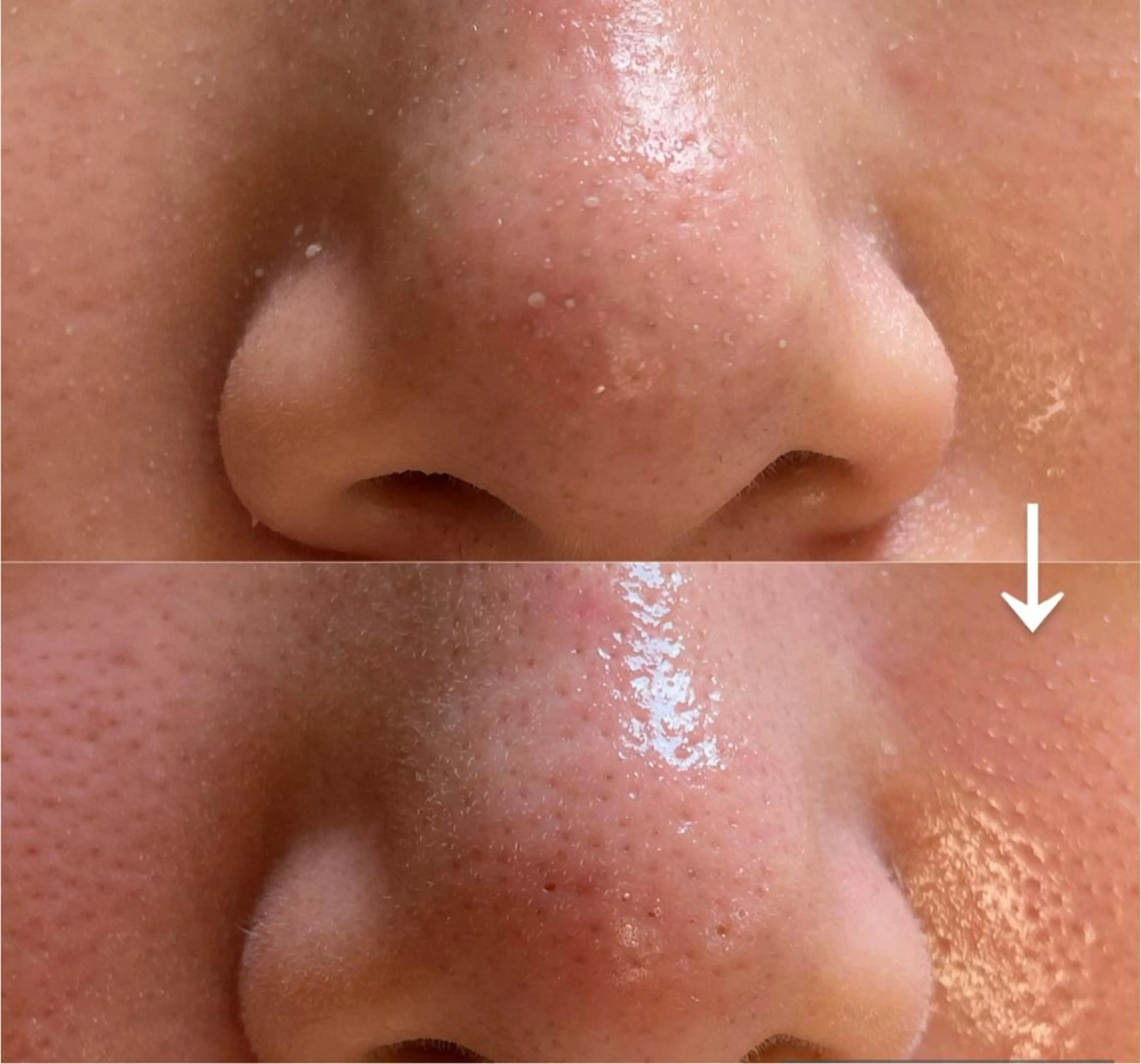 毛穴レス ハーブ＆ ワックス脱毛×光脱毛のエステ・リラクイメージ