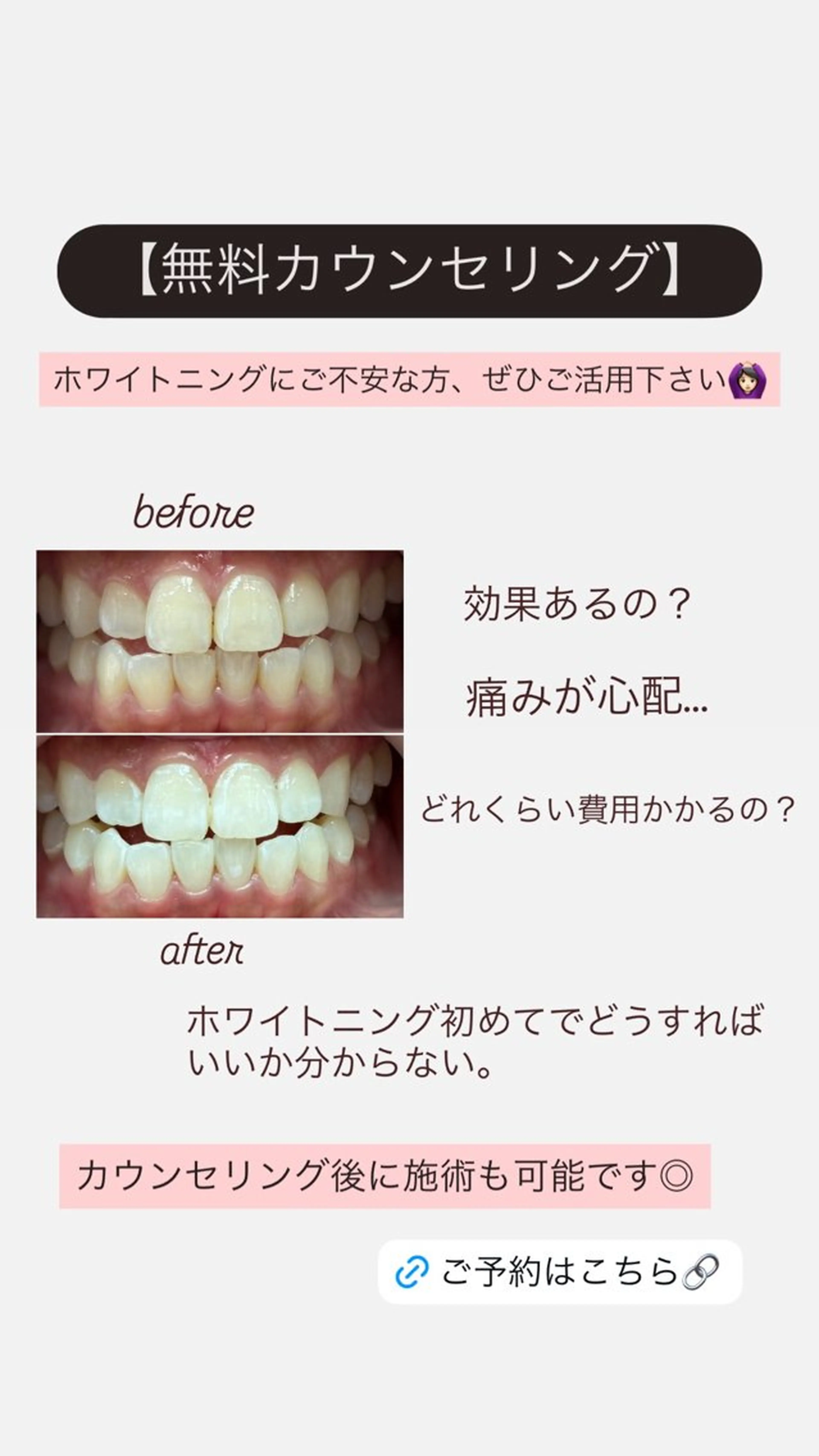 ホワイトニングサロン yatto.のその他イメージ