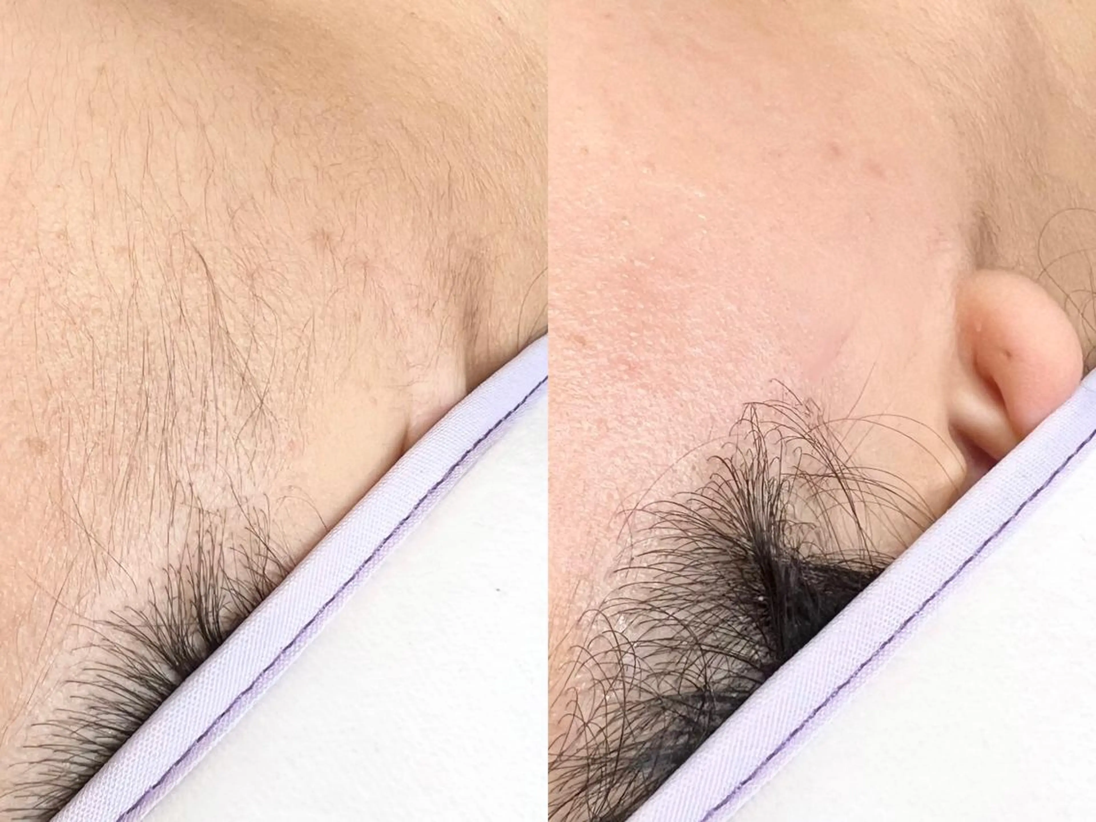 🆕【今話題の！！】フェイシャルワックスモニター様の写真