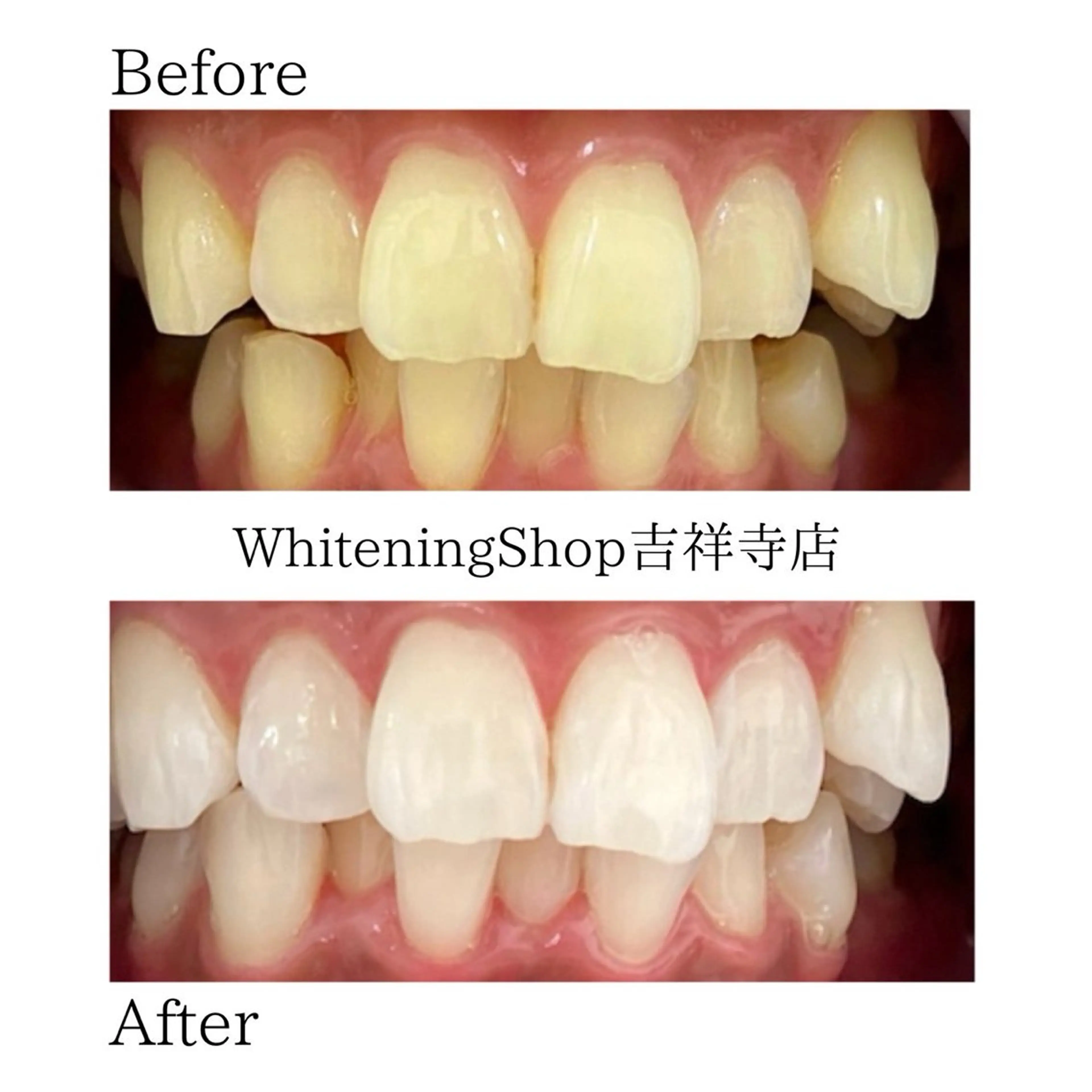 エステ リラク ホワイトニング ショップ吉祥寺店のエステ・リラクイメージ