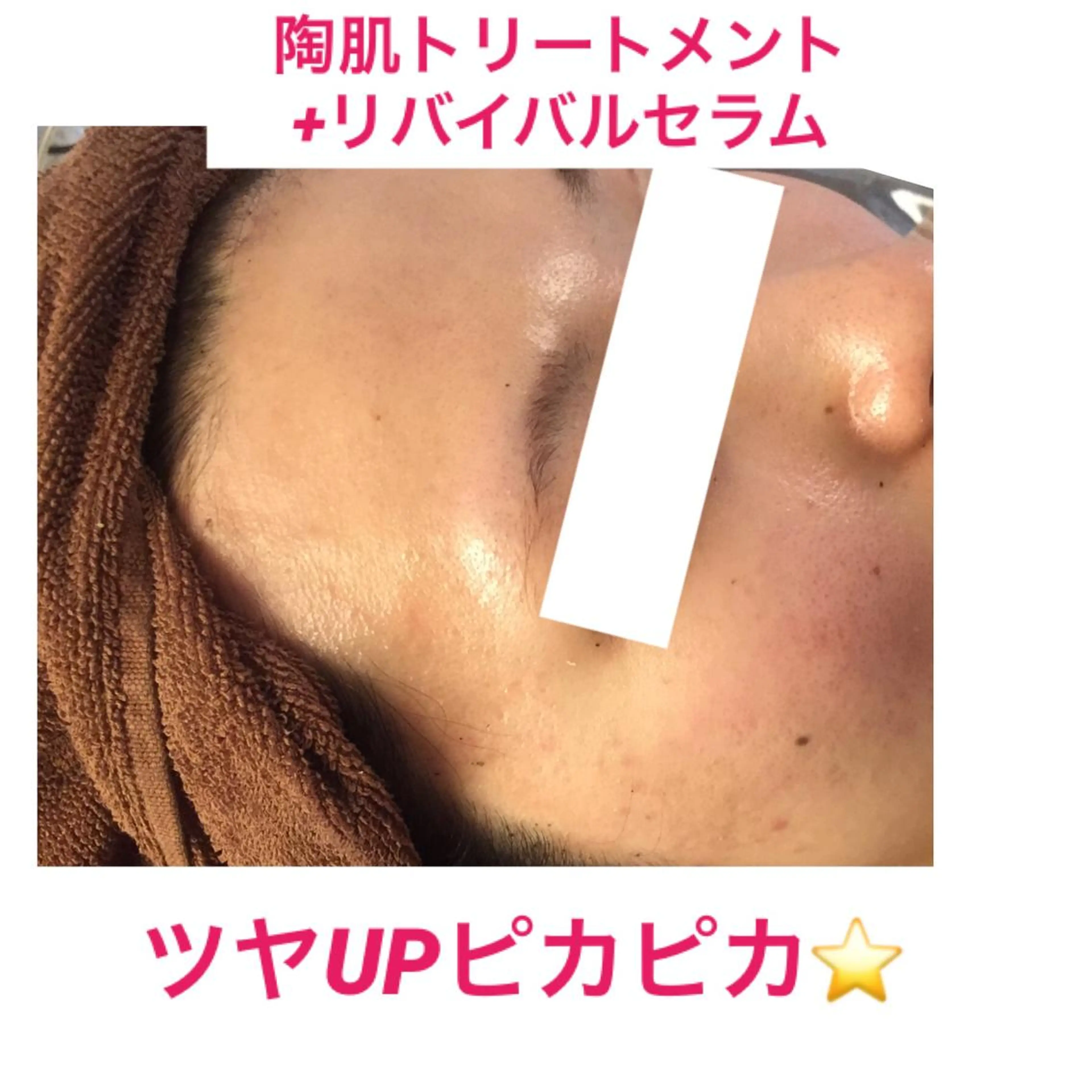 痩身専門サロン ビューティーグランツのエステ・リラクイメージ