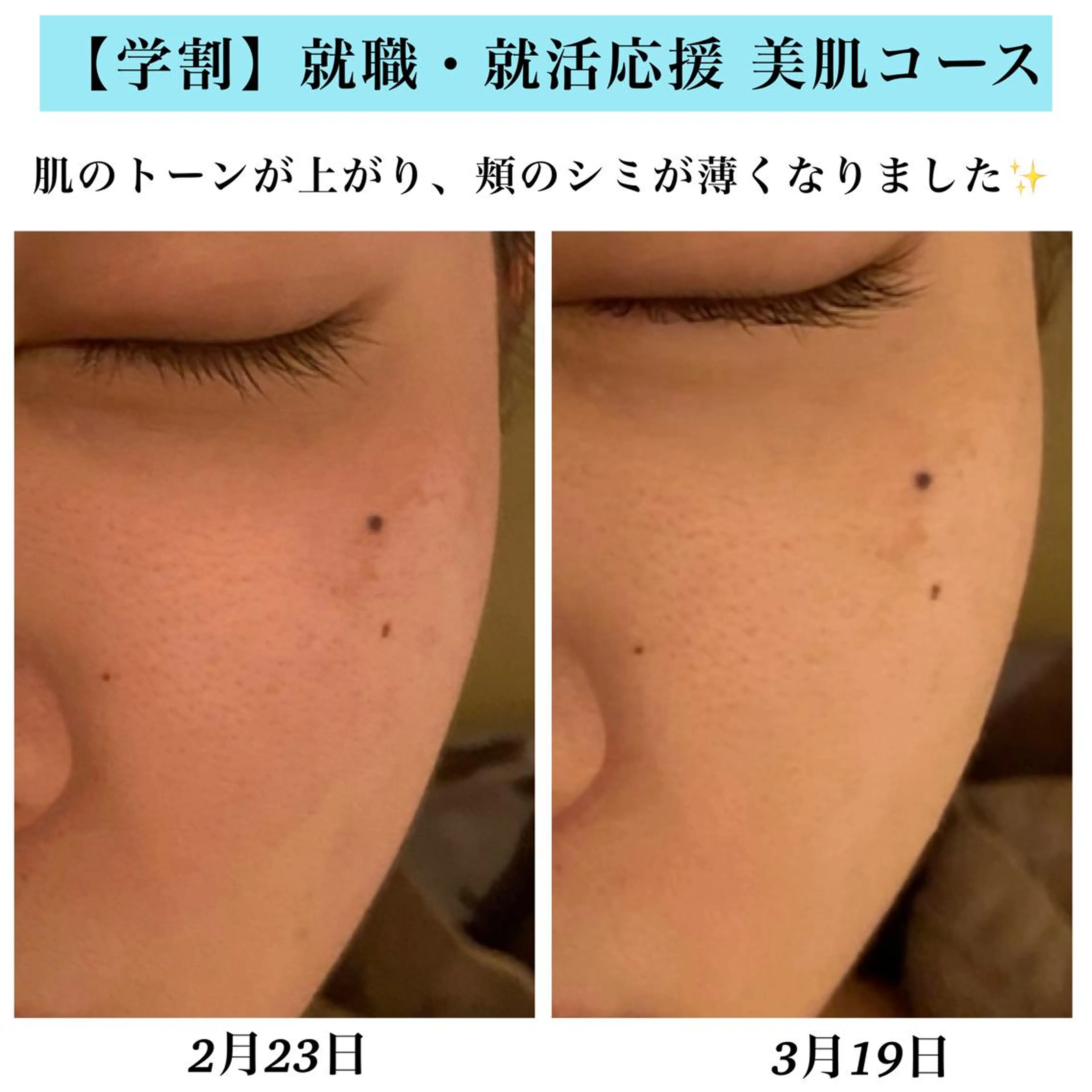 エステ Bellesthe （ベルエステ）のエステ・リラクイメージ