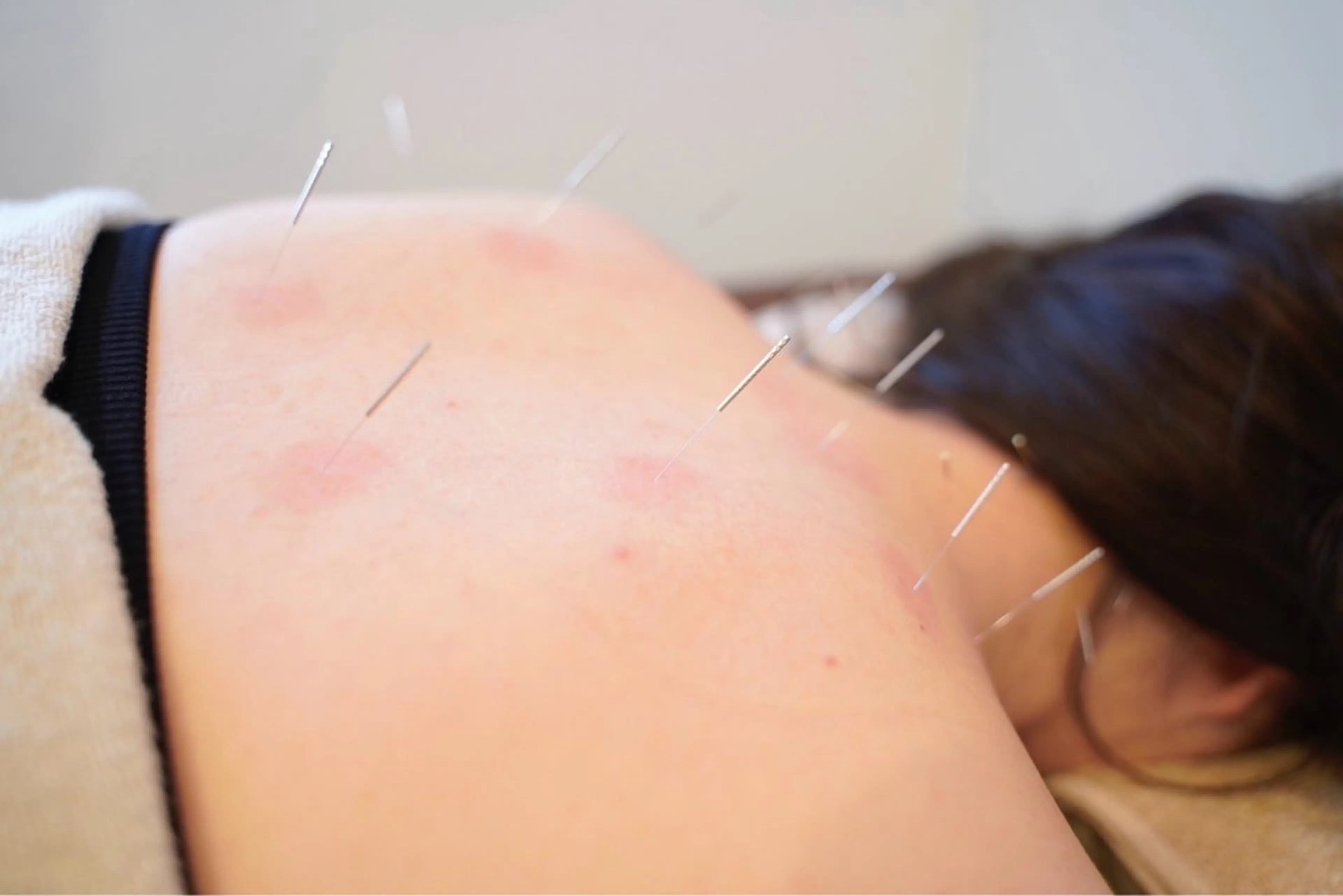 エステ リラク STRI-ストリ-所属・🌈よもぎ蒸し/ アカスリ/鍼/整体のエステ・リラクイメージ