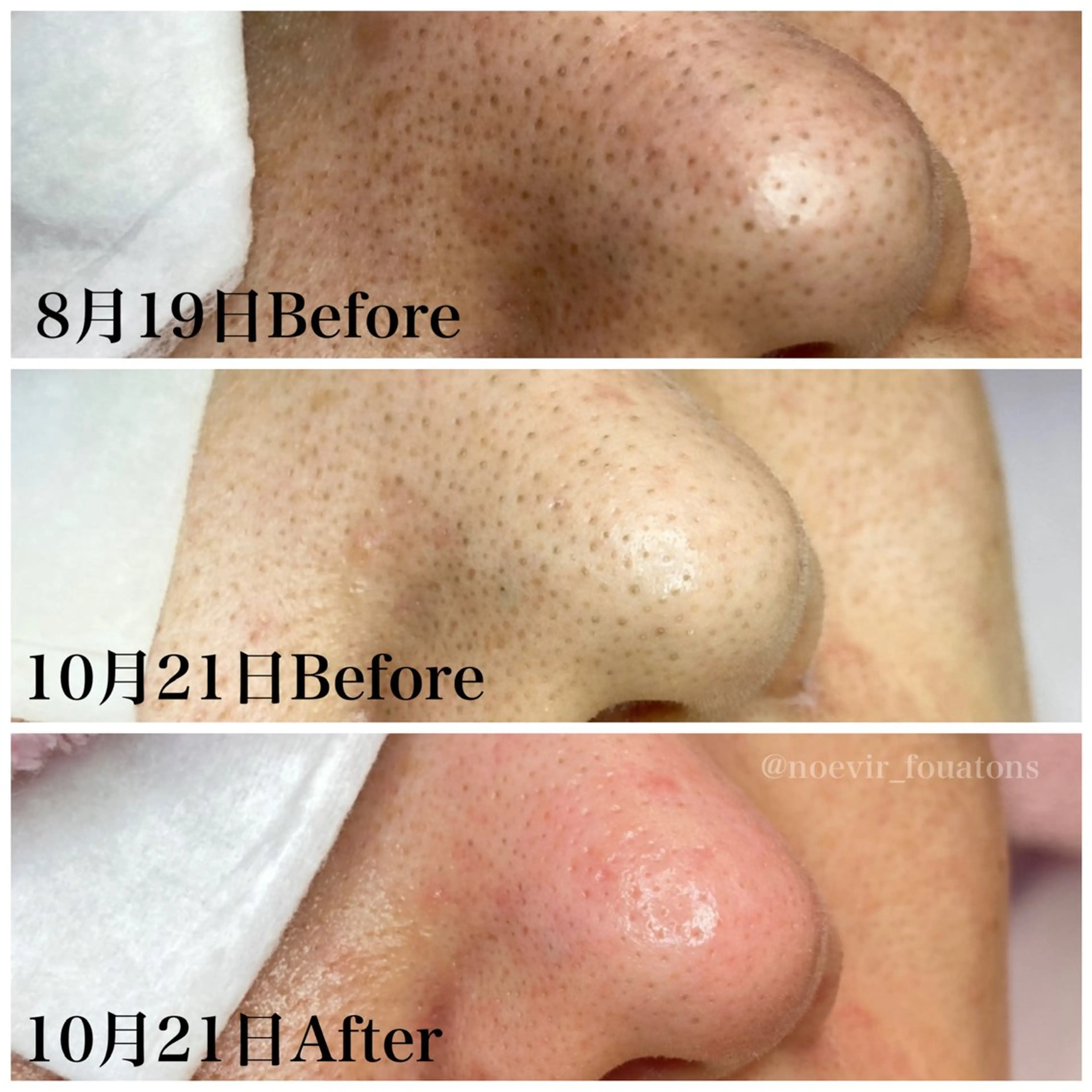 ﾌｪｲｼｬﾙｴｽﾃ ふわっとんのエステ・リラクイメージ