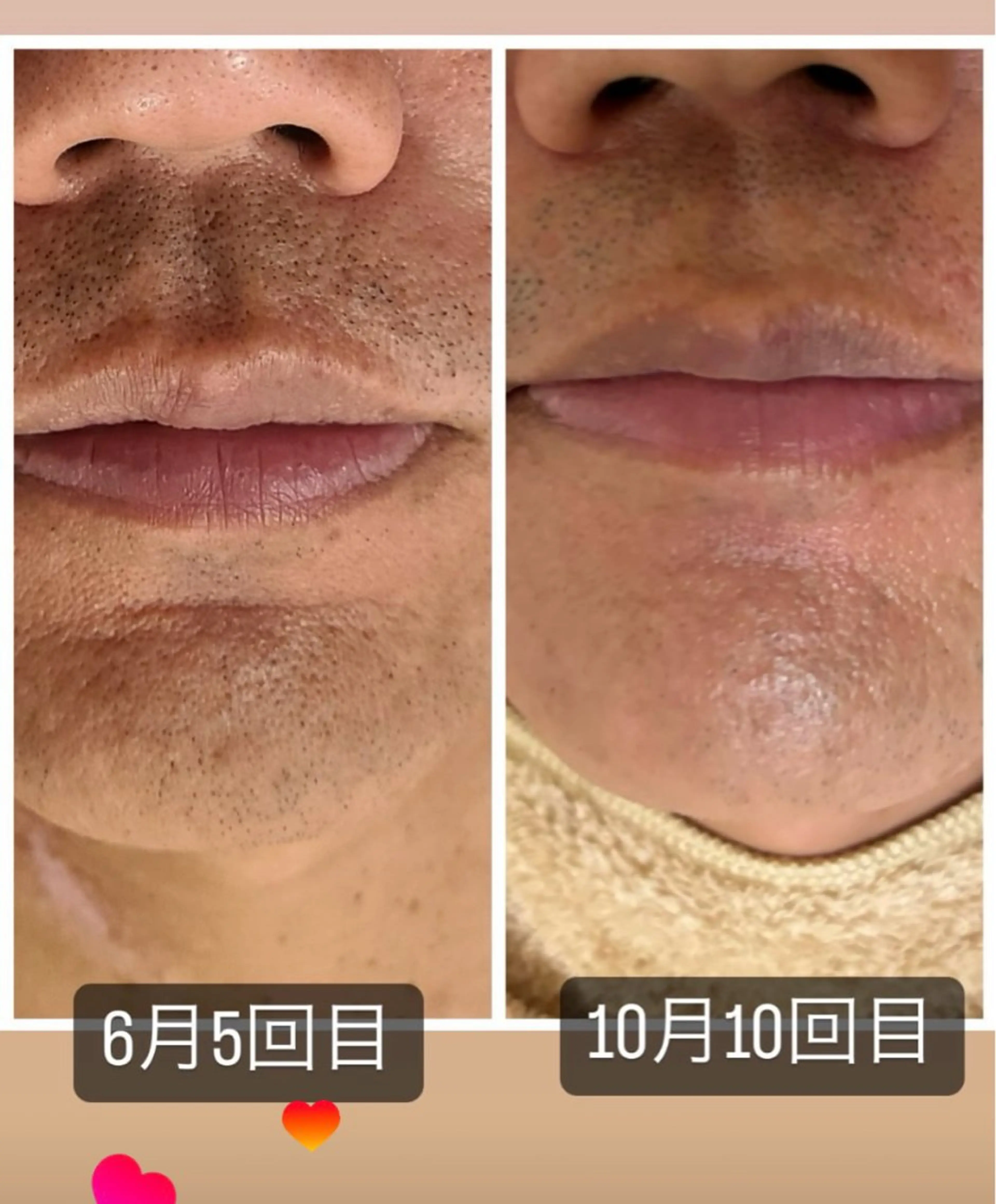 メンズ サロンドジュエル ueteのエステ・リラクイメージ