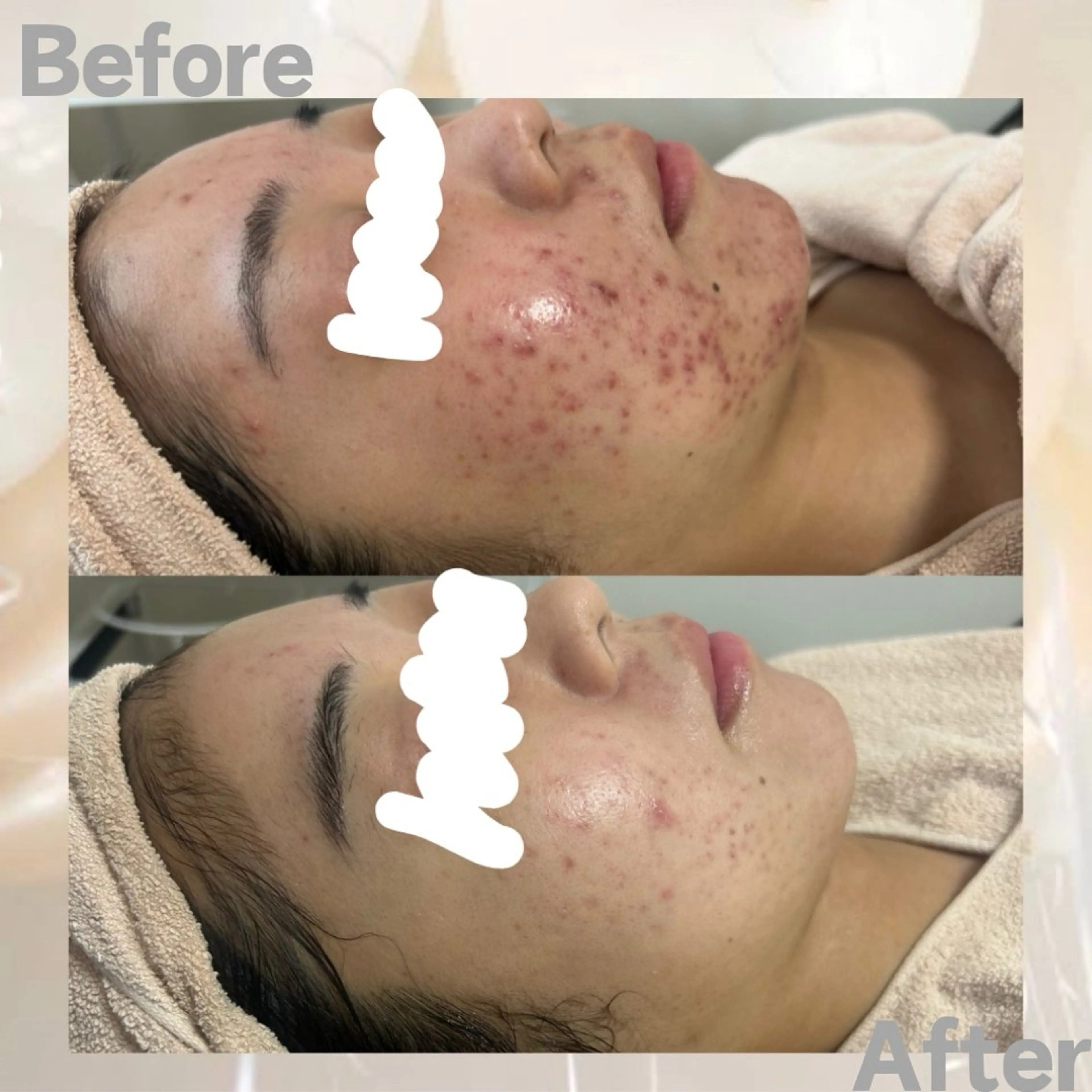 エステ 都度払い肌改善専門店 店長二上文香のエステ・リラクイメージ