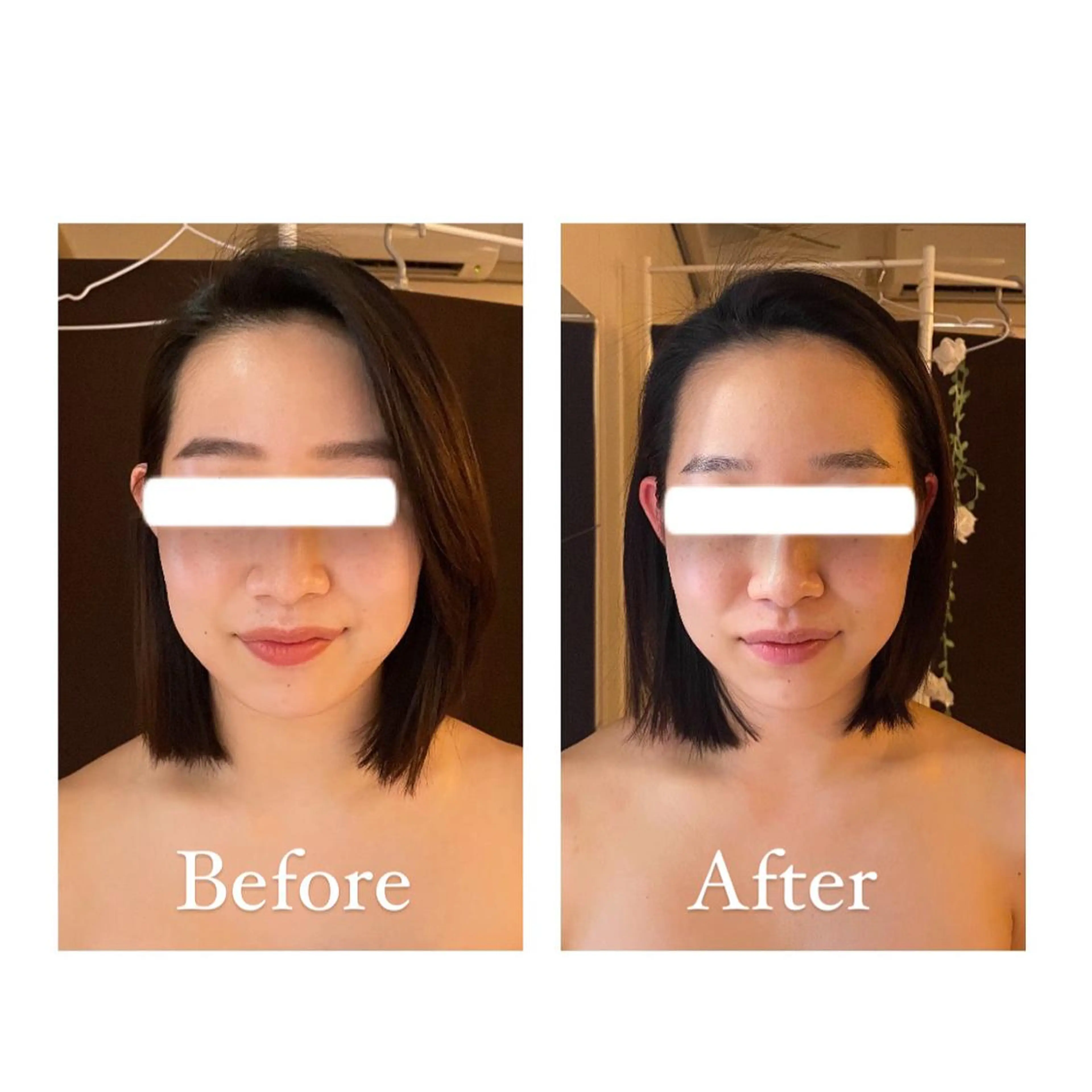 寧♡ 美肌小顔・ボディケアのエステ・リラクイメージ