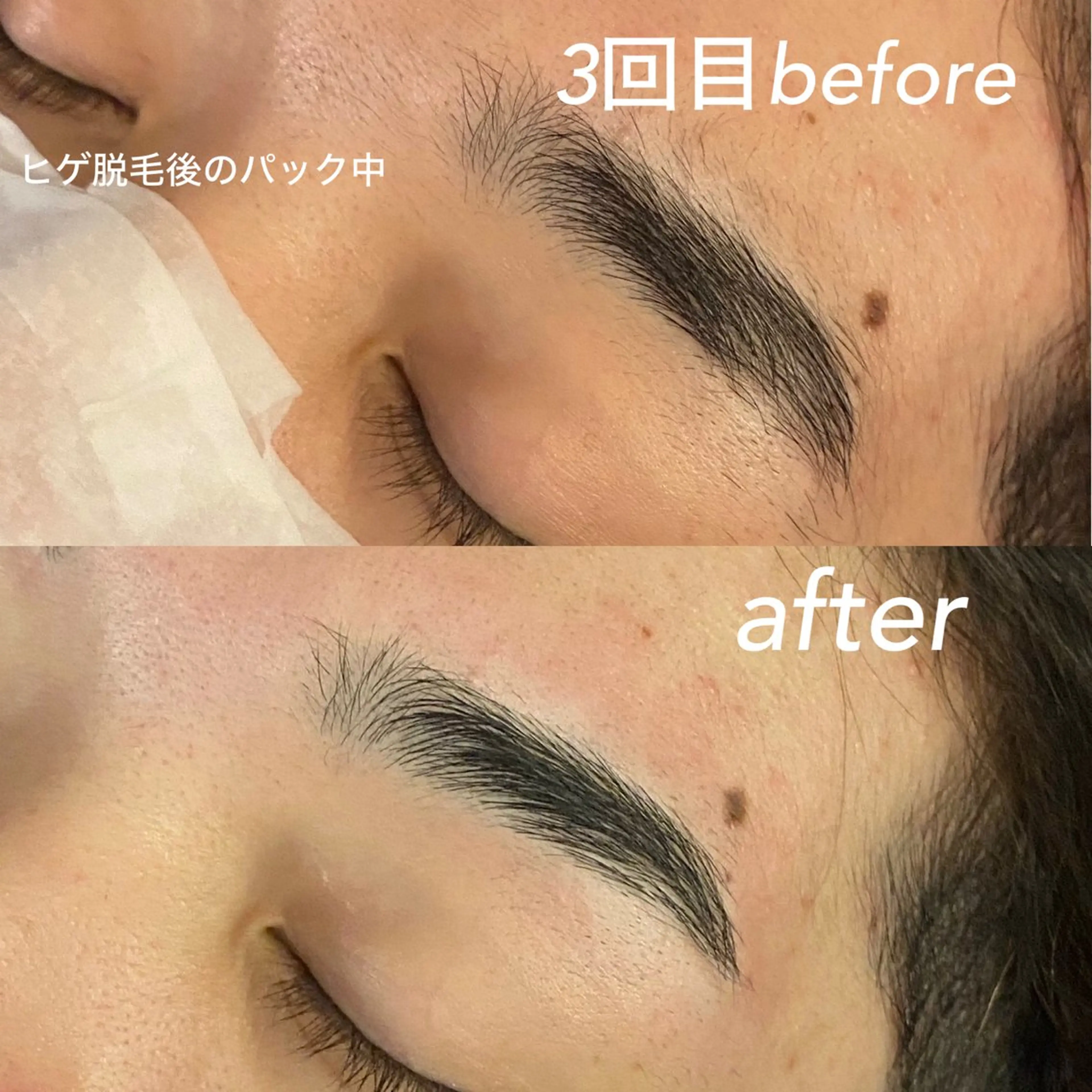 メンズ アイブロウ 眉毛ワックス脱毛 メンズガーデン yuriのネイルデザイン