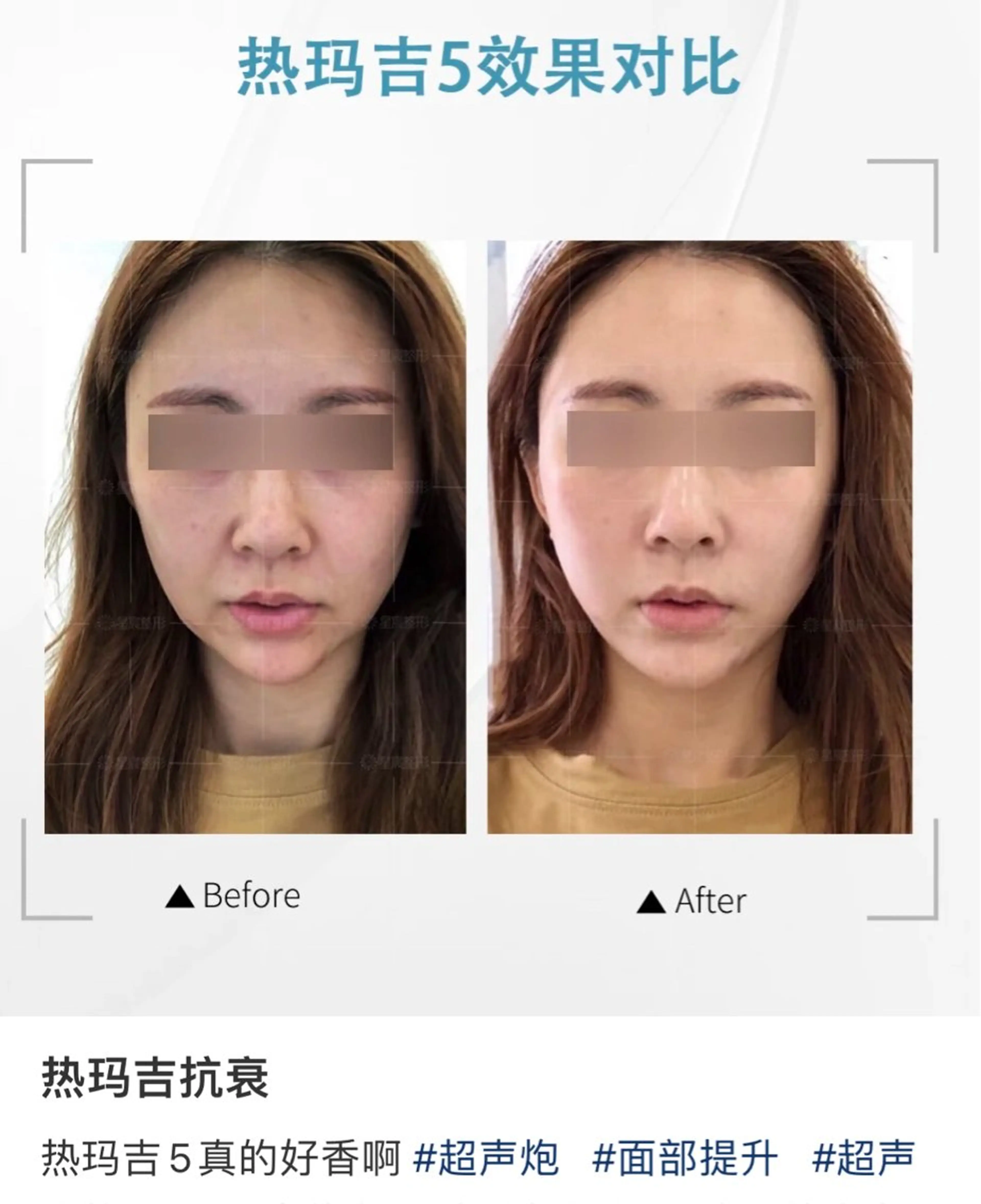 ショート aliaハーブ水光店 エステティシャン募集のエステ・リラクイメージ