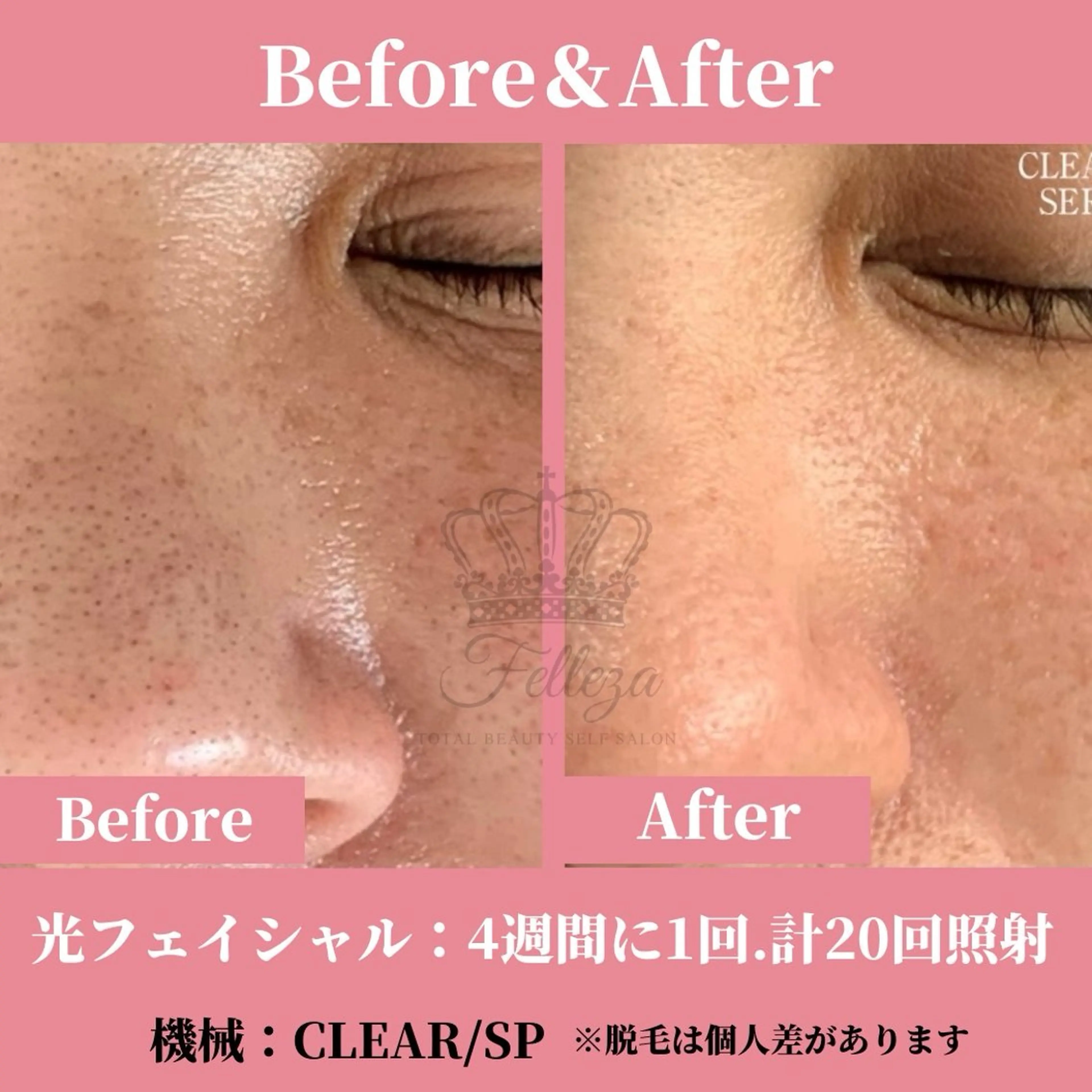 メンズ 有人型セルフサロン 脱毛／痩身／美顔のエステ・リラクイメージ