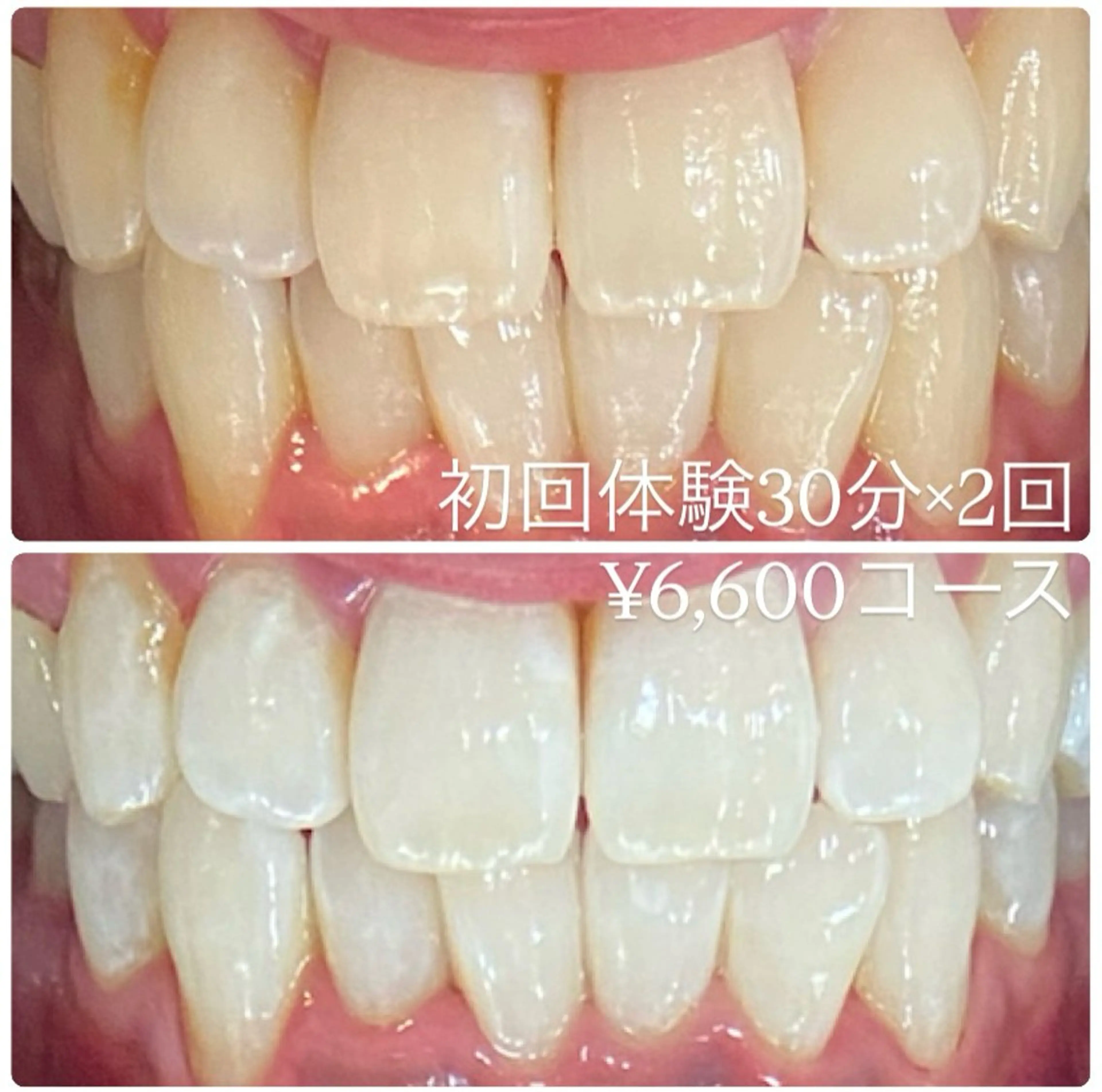 PLATINUM Beauty 横浜店所属・ホワイトニングルーム 横浜店のその他イメージ