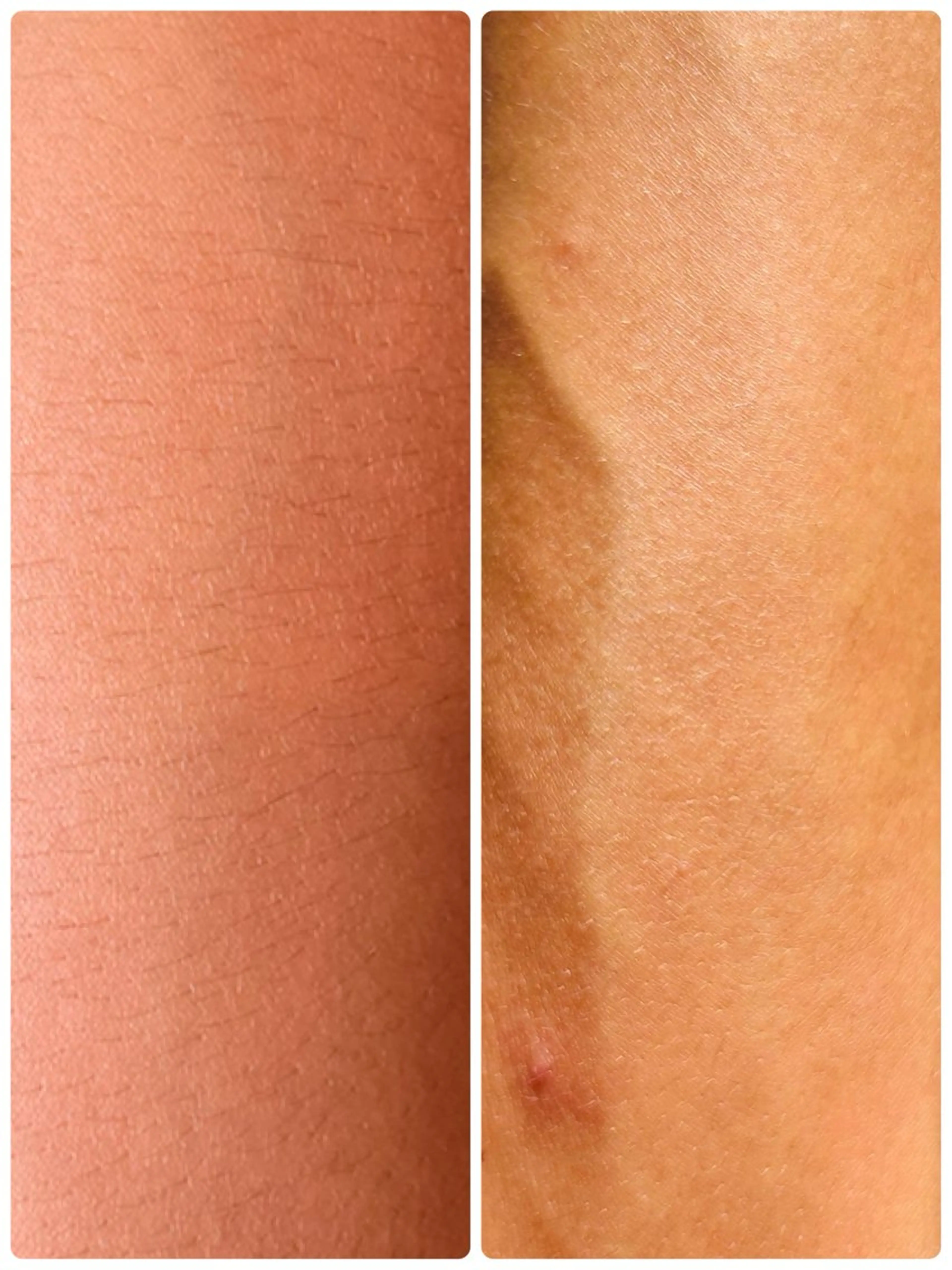 yellow.所属・yellow💛【 脱毛&フェイシャル】のエステ・リラクイメージ