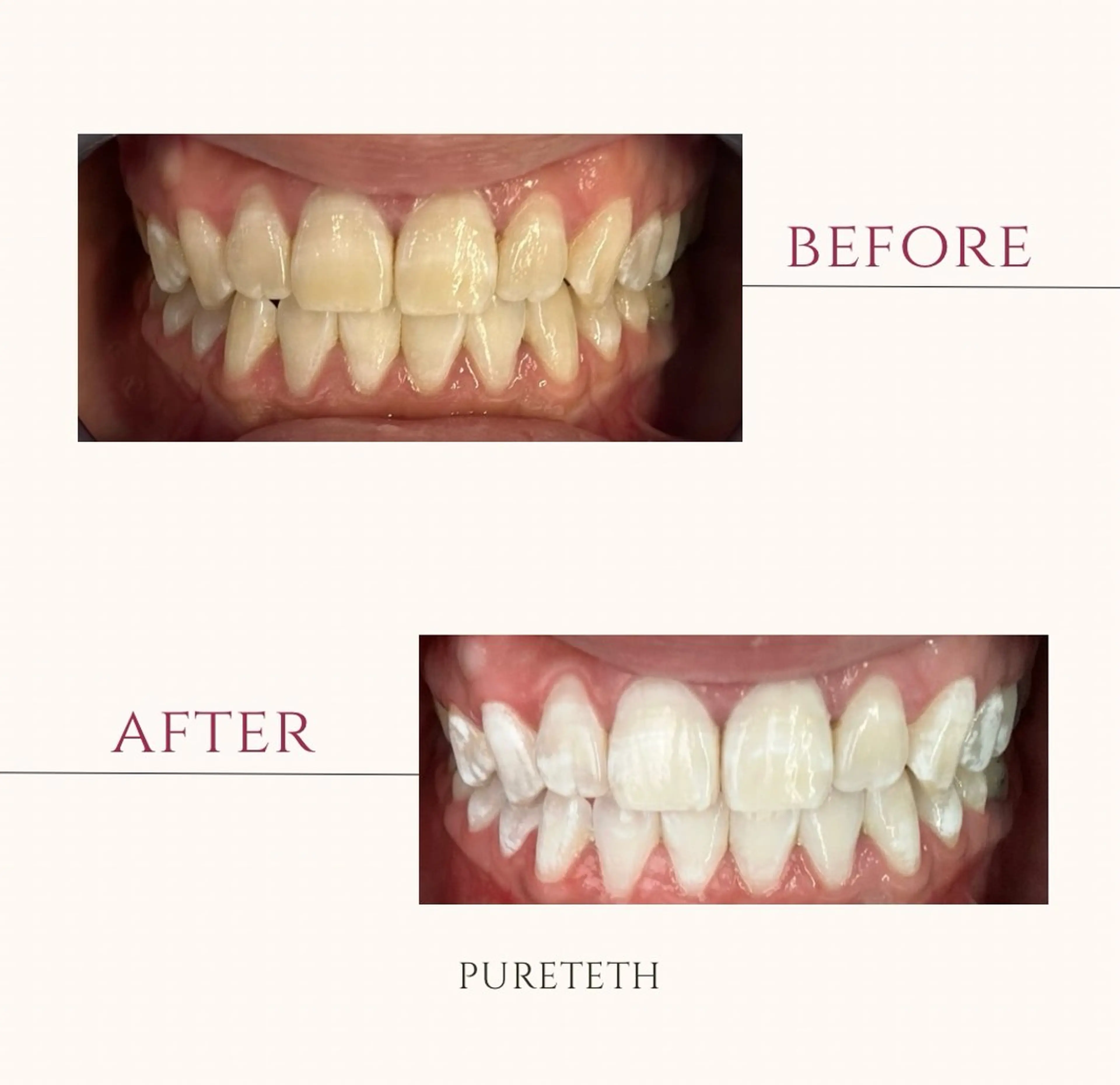 その他 ホワイトニングサロンPURETETH所属・ホワイトニングサロン PURETETHのエステ・リラクイメージ