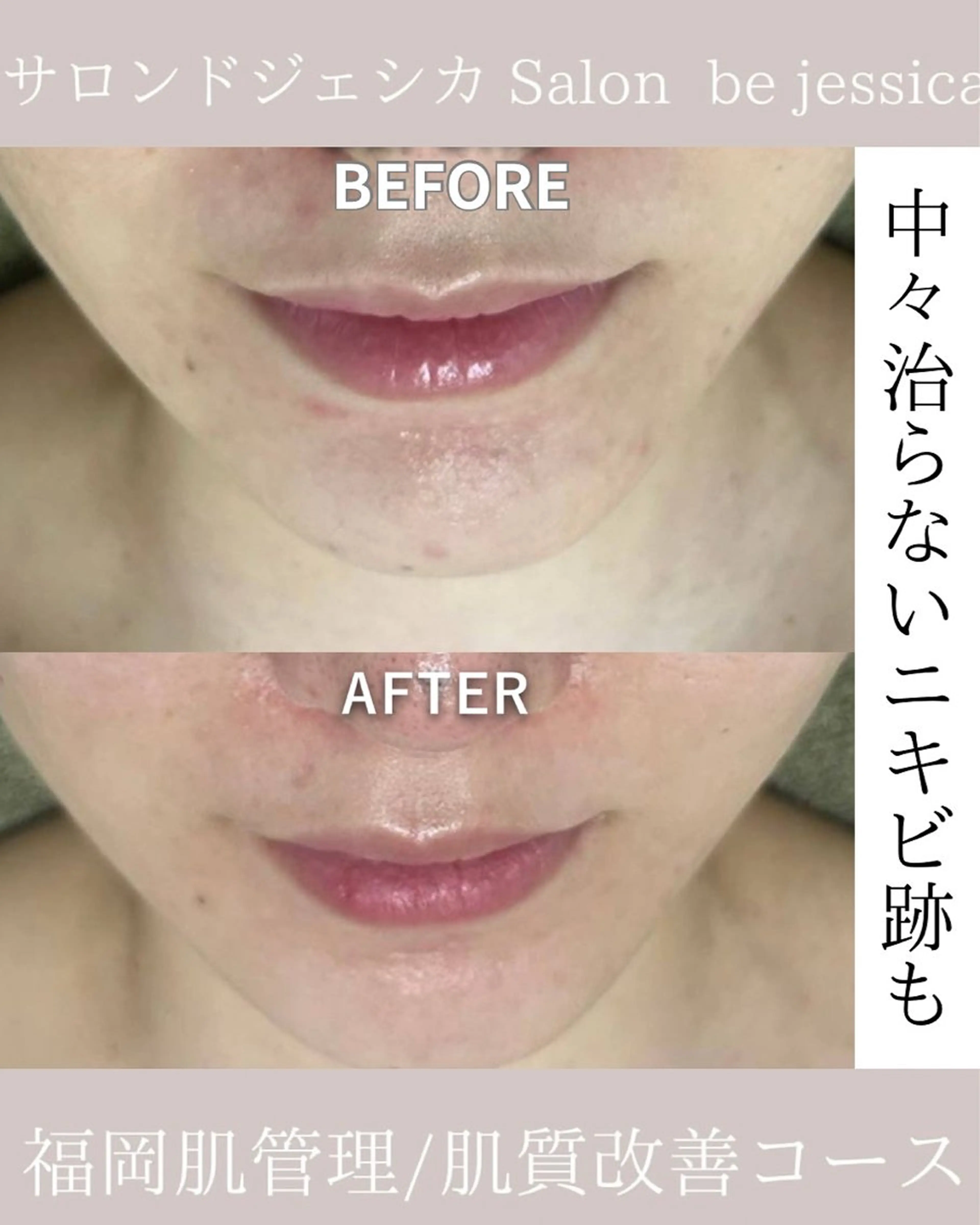 エステ 韓国美肌/肌質改善 【天神】のエステ・リラクイメージ