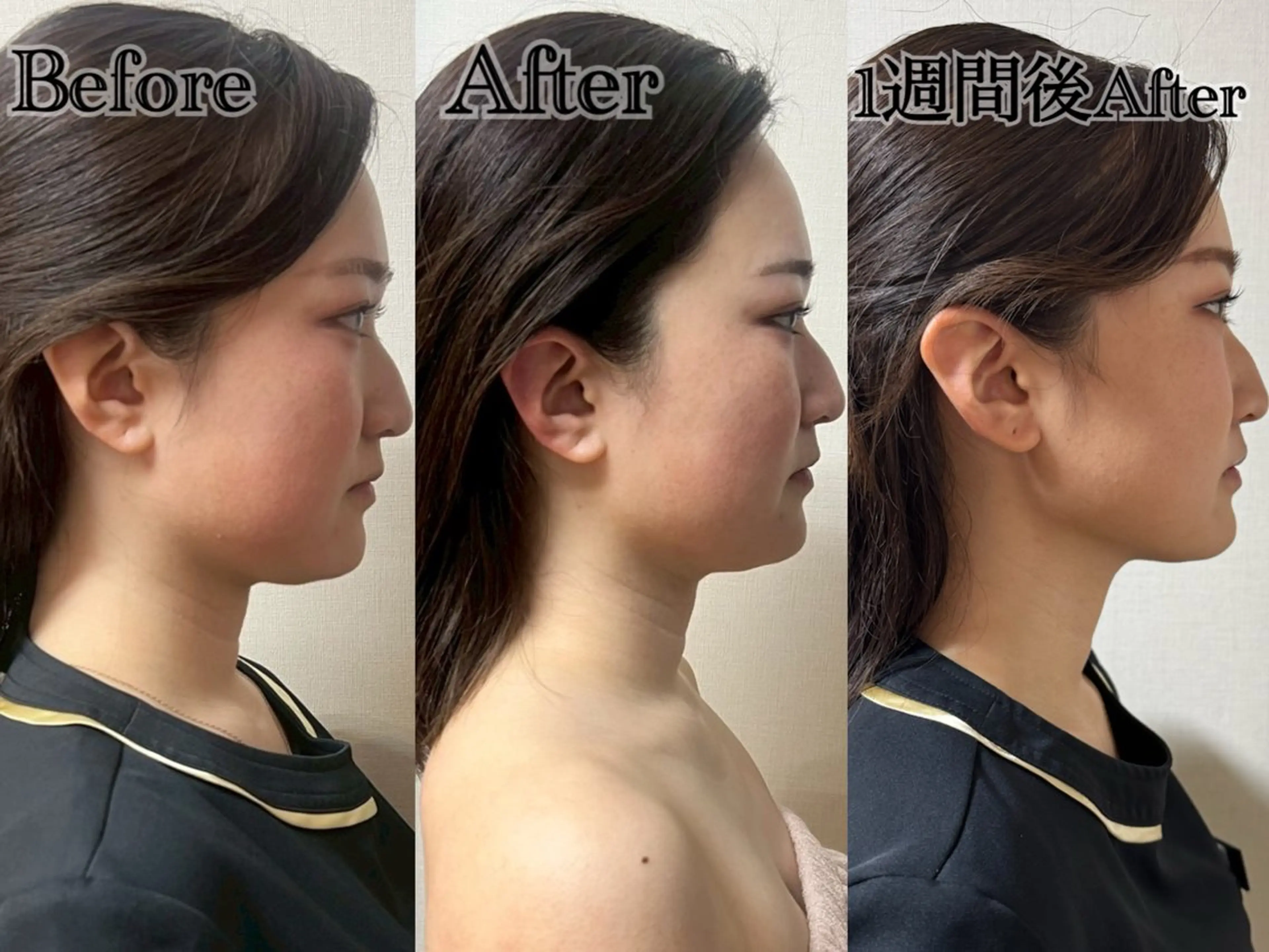 エステ 六本木脱毛andS 店長Sachiのエステ・リラクイメージ