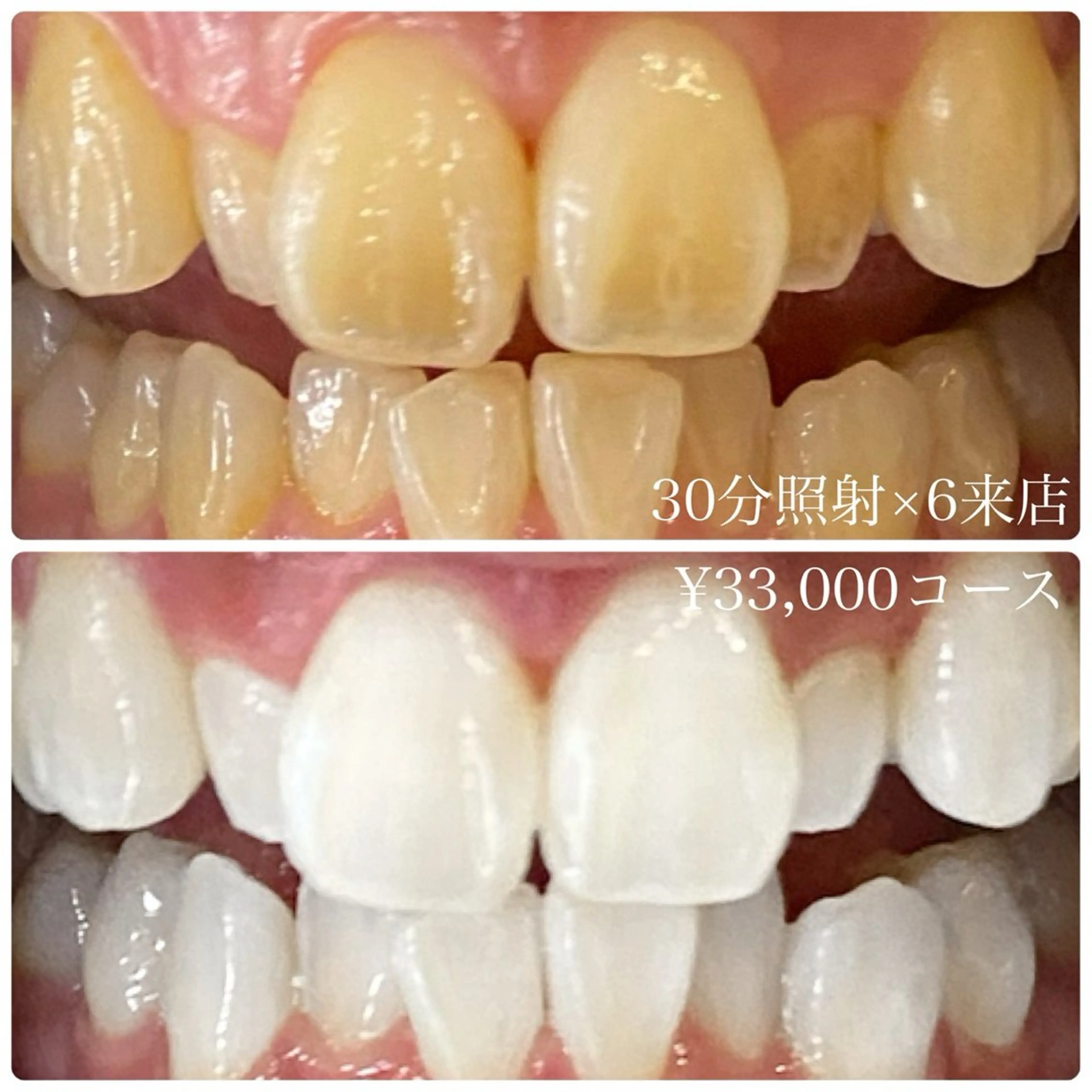 PLATINUM Beauty 横浜店所属・ホワイトニングルーム 横浜店のその他イメージ