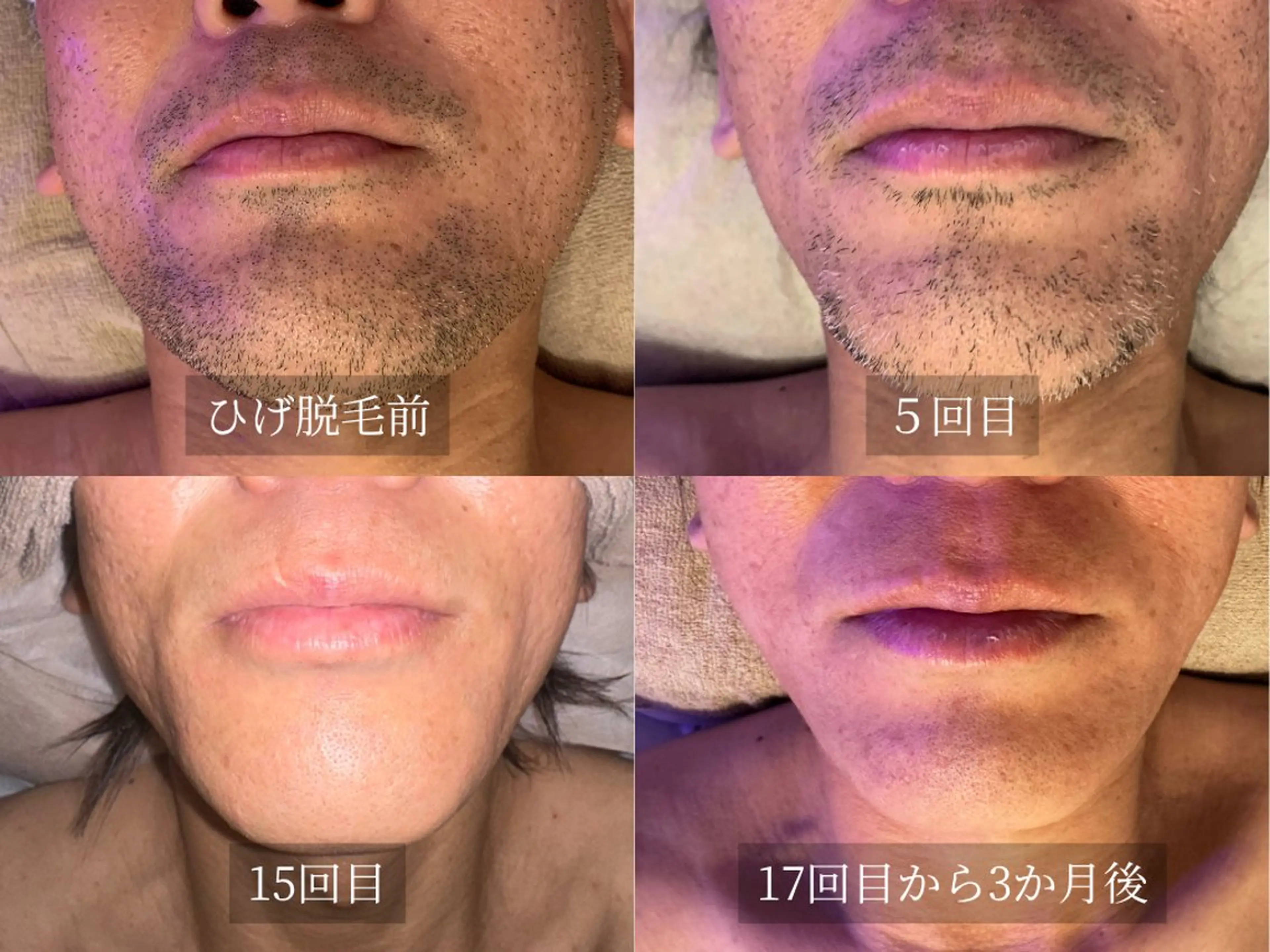 脱毛サロン Arumのエステ・リラクイメージ