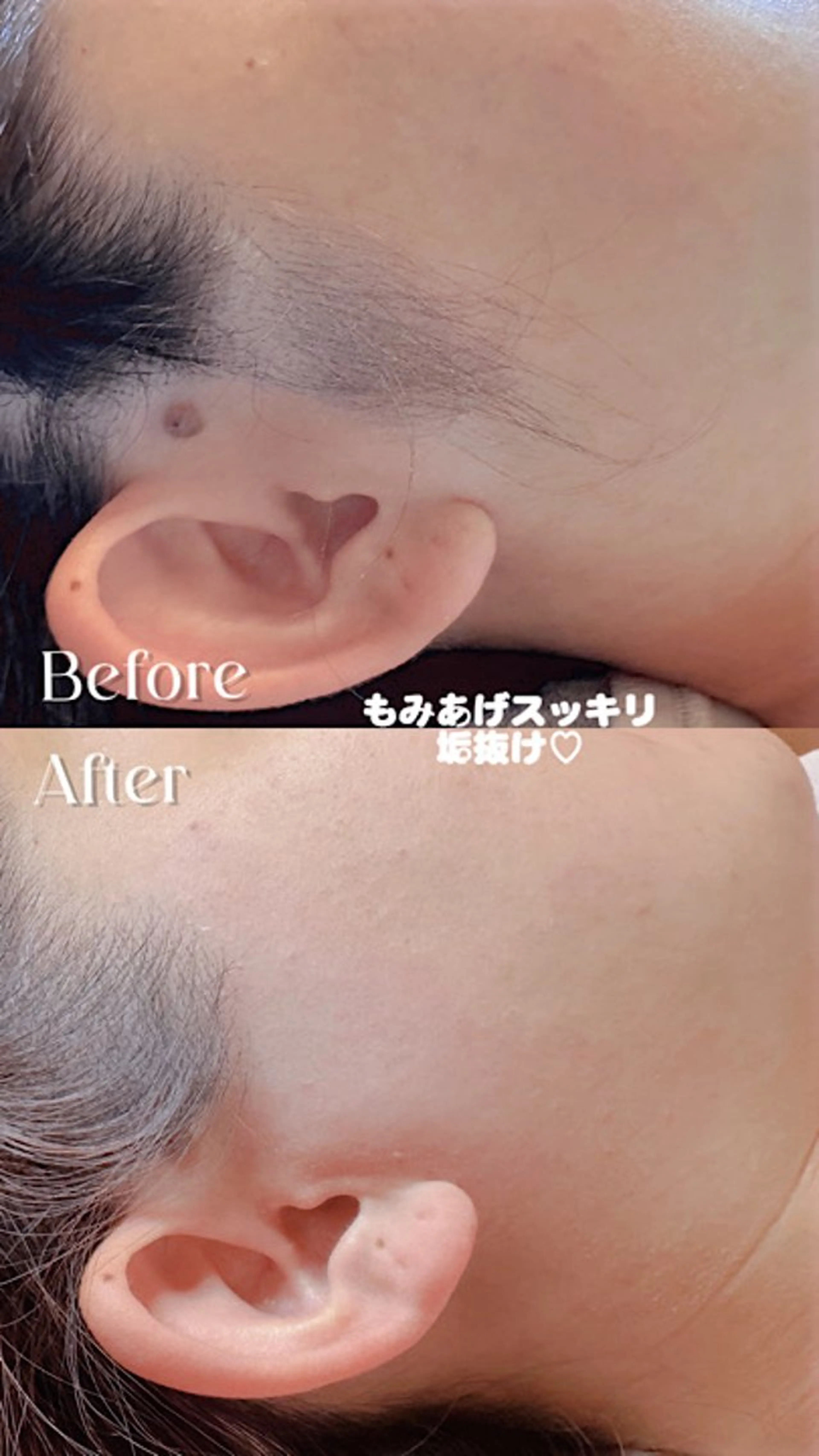 Hitomi シュガーリング豊橋のその他イメージ