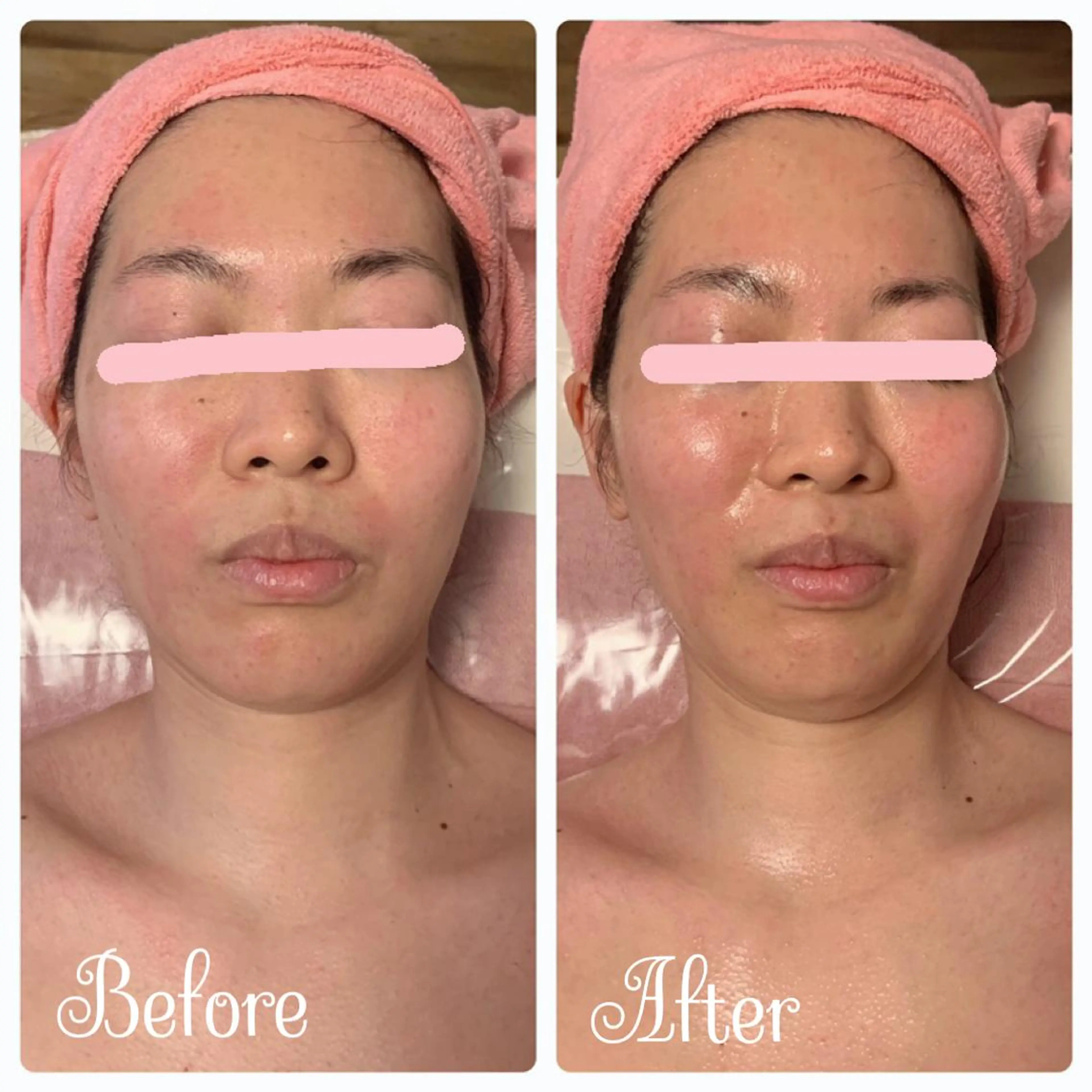 Linomalie エステ/たるみ/脱毛のエステ・リラクイメージ