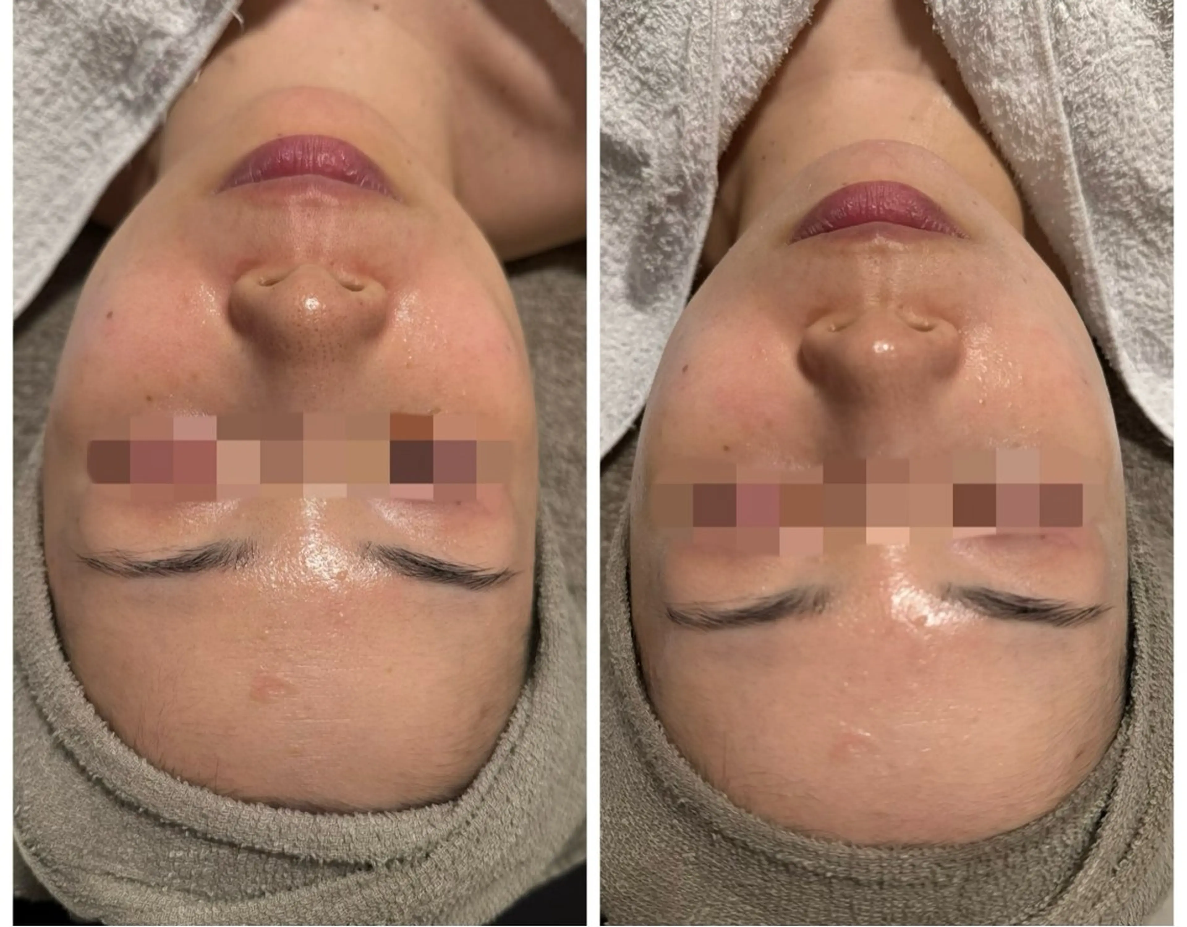 lumi riseのエステ・リラクイメージ