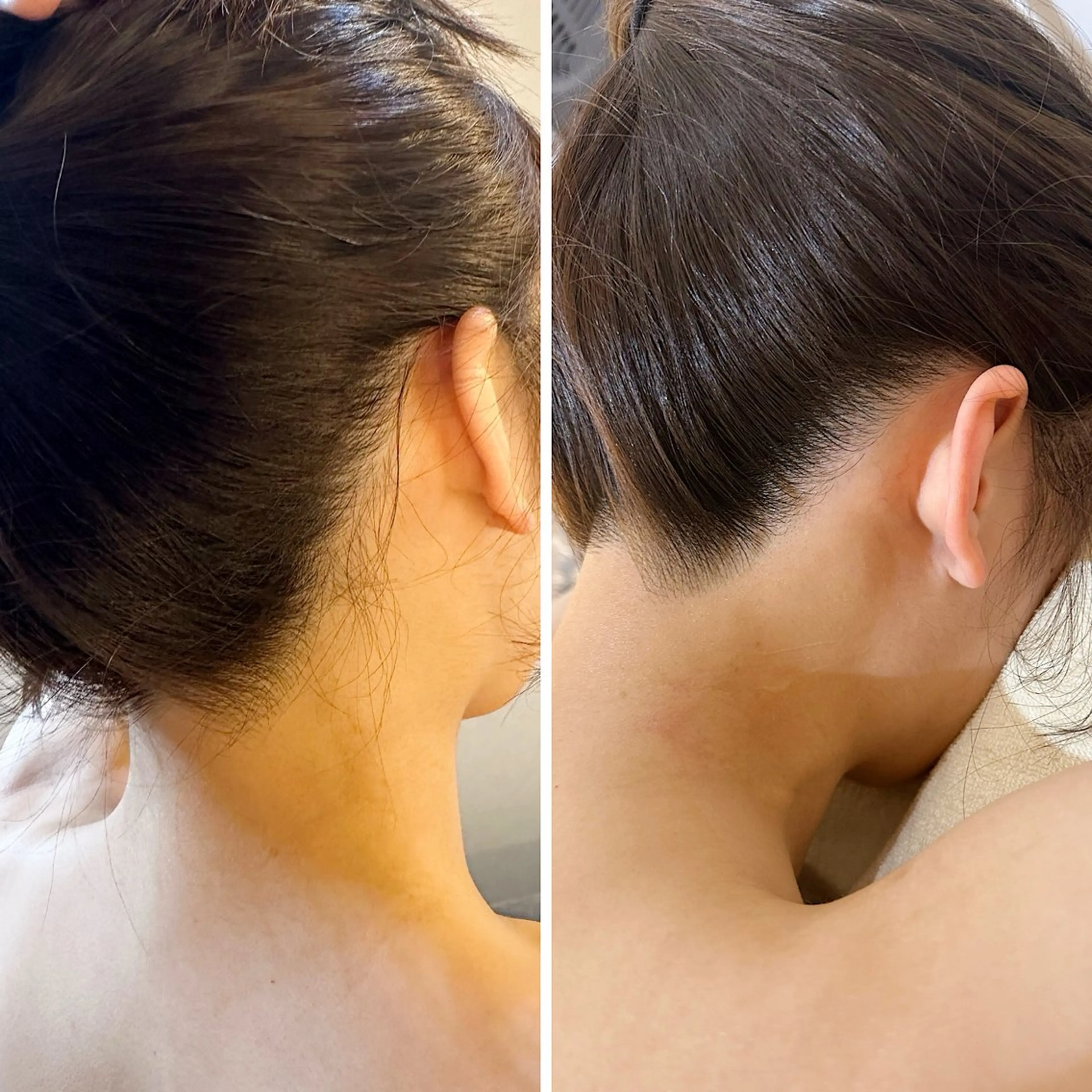 脱毛 うなじ脱毛/美肌脱毛 LABELのエステ・リラクイメージ