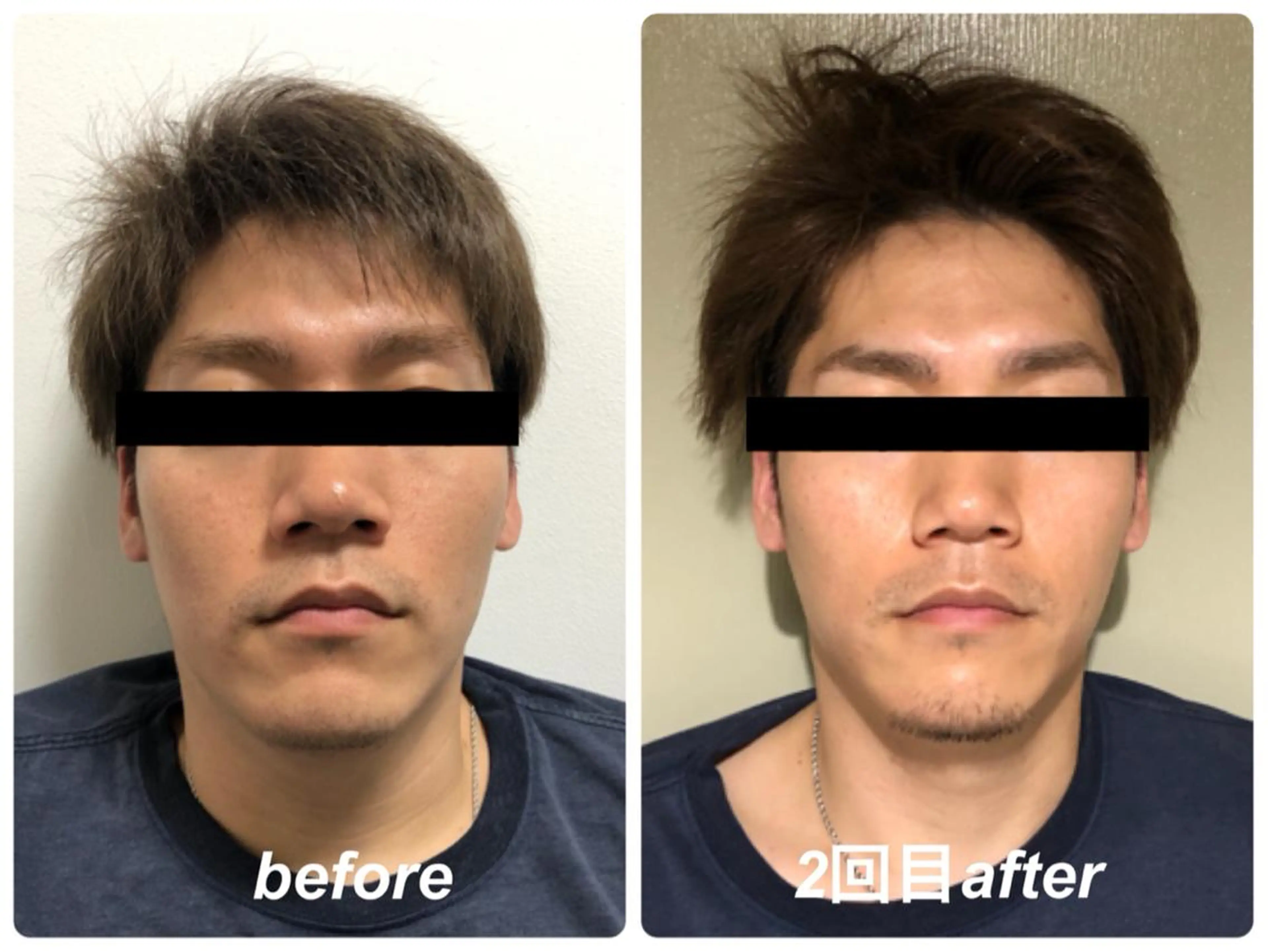 Radiance H.Oのエステ・リラクイメージ