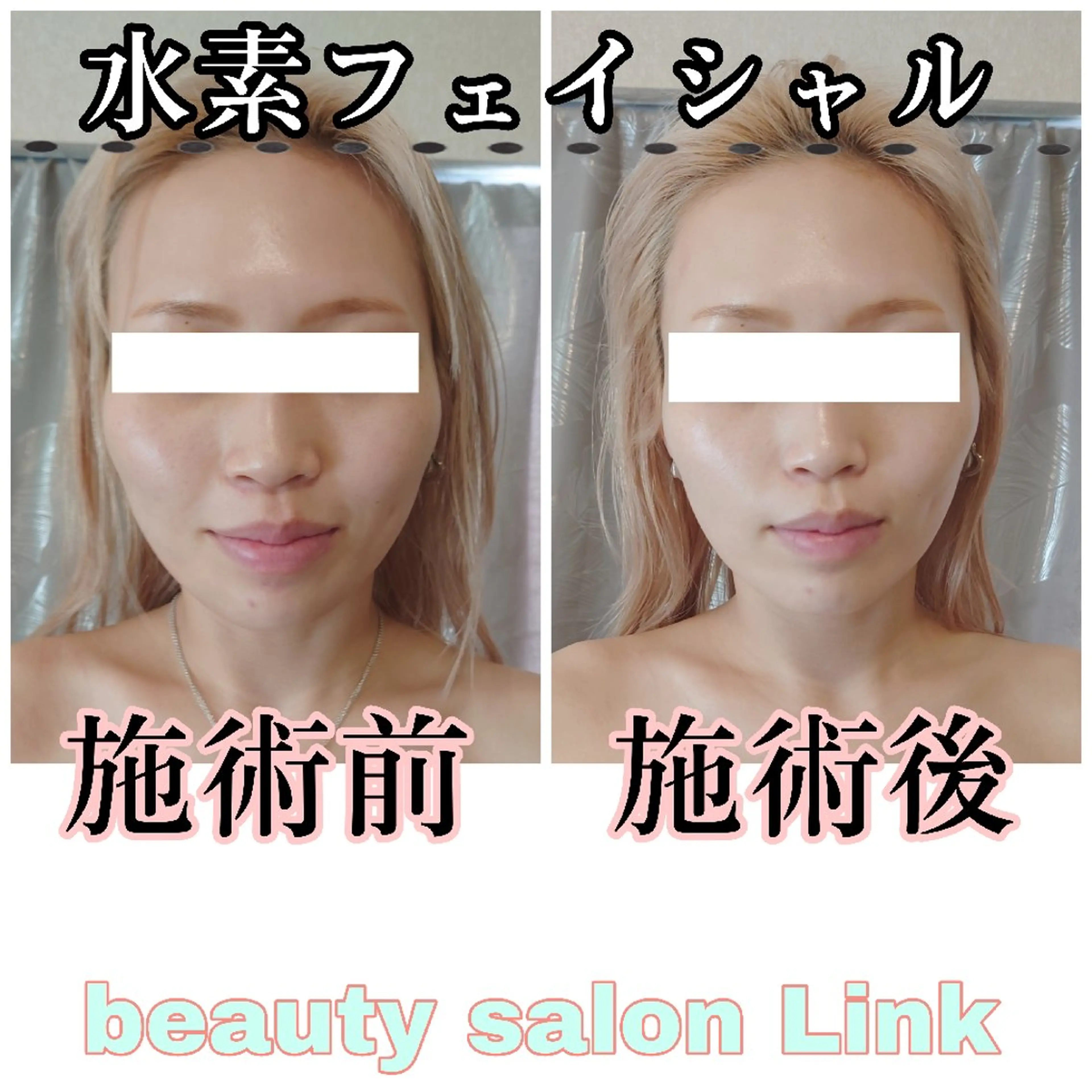 水素エステと美容脱毛 salon Linkのエステ・リラクイメージ