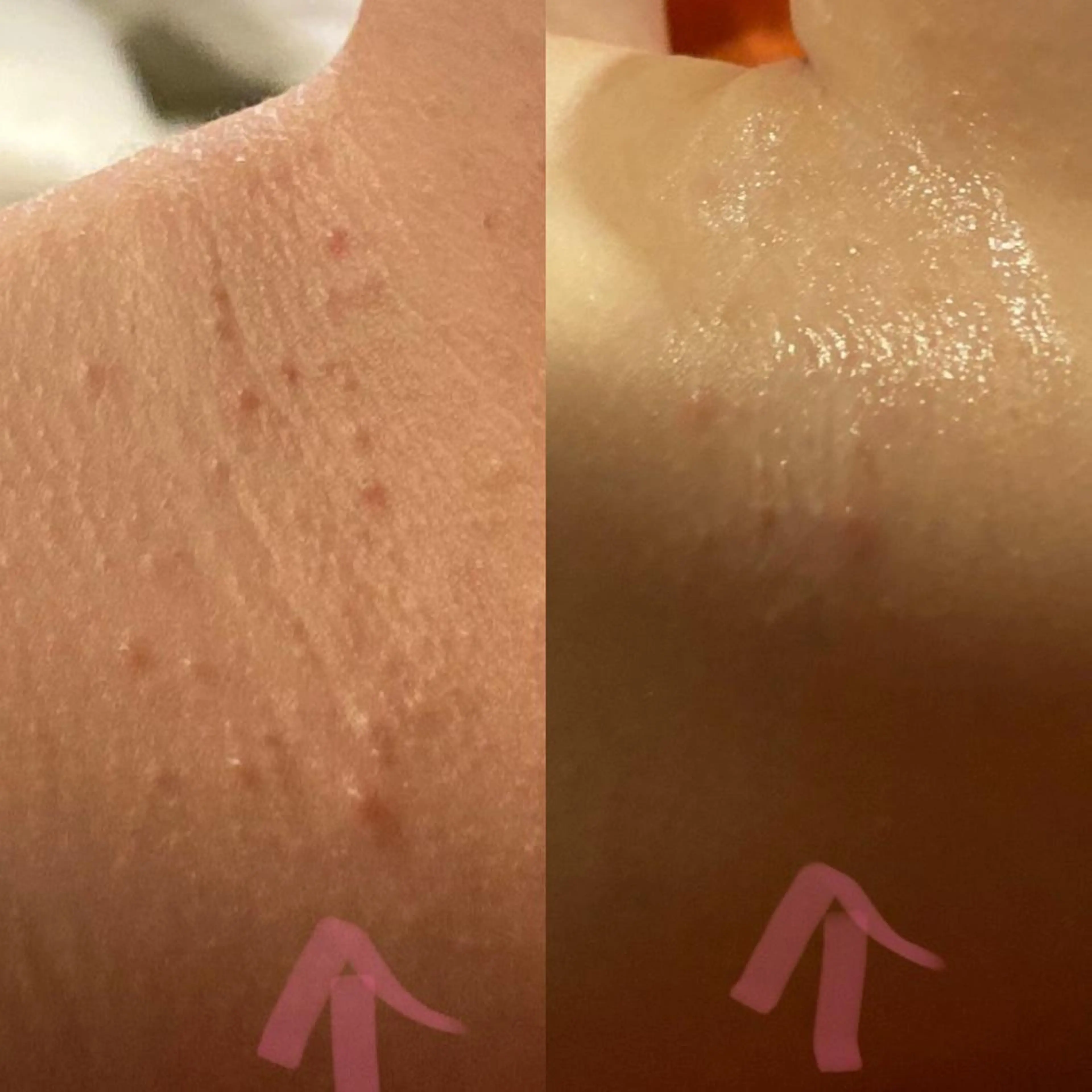 毛穴から始める肌メン テマンダリンオレンジのエステ・リラクイメージ