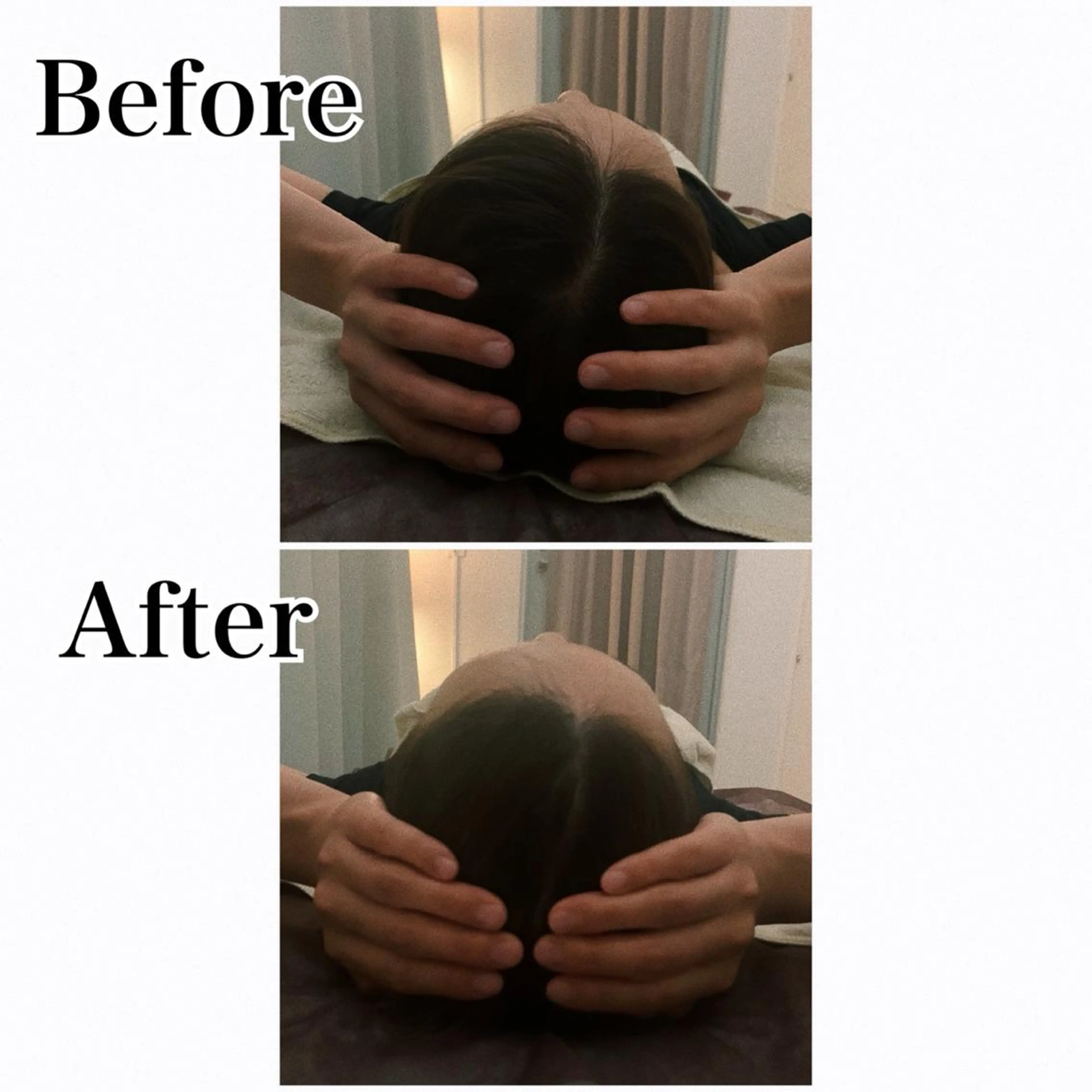 ielu〜毛穴ケア ハーブピーリングのエステ・リラクイメージ