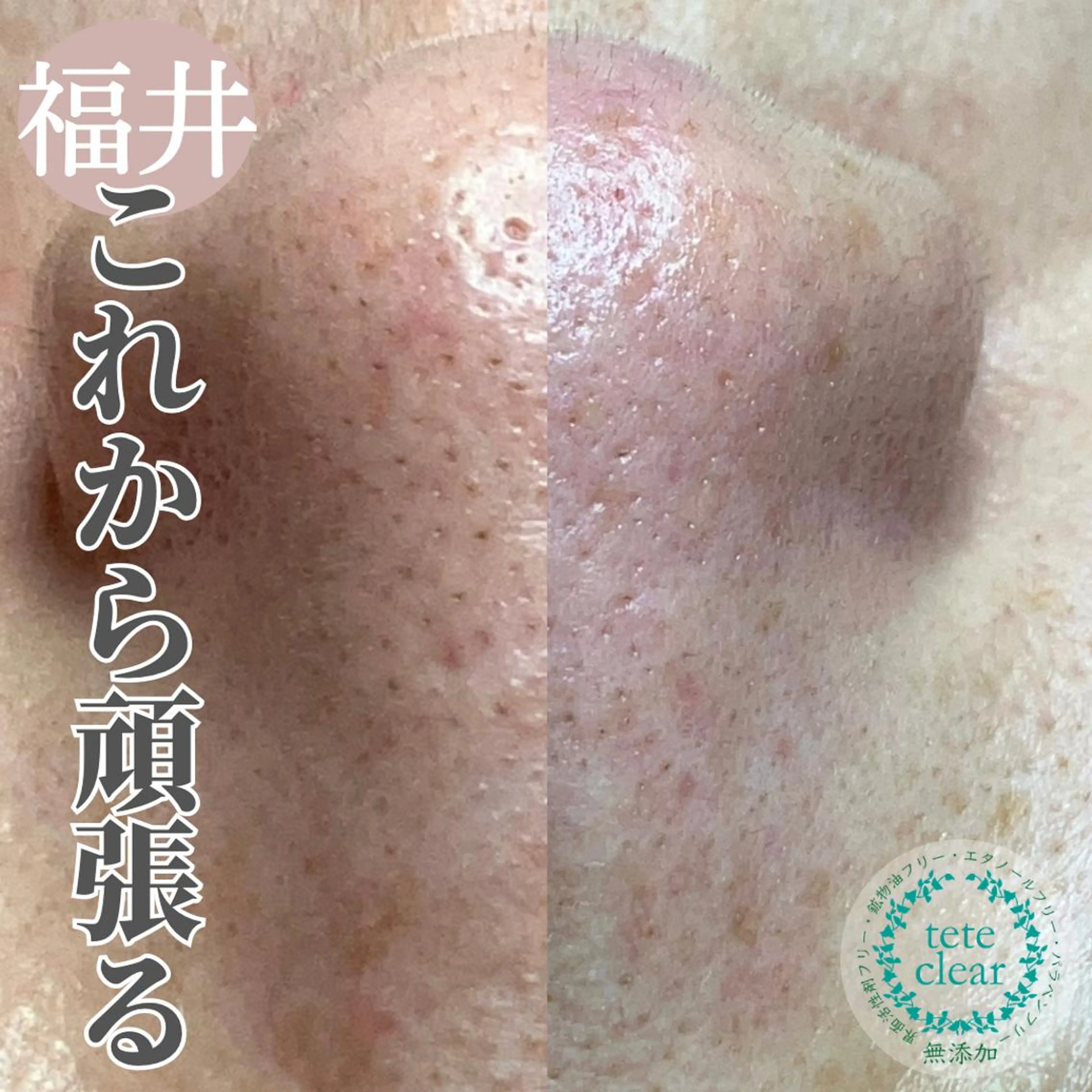 毛穴肌質ケアサロン Yourmeユアミーのエステ・リラクイメージ