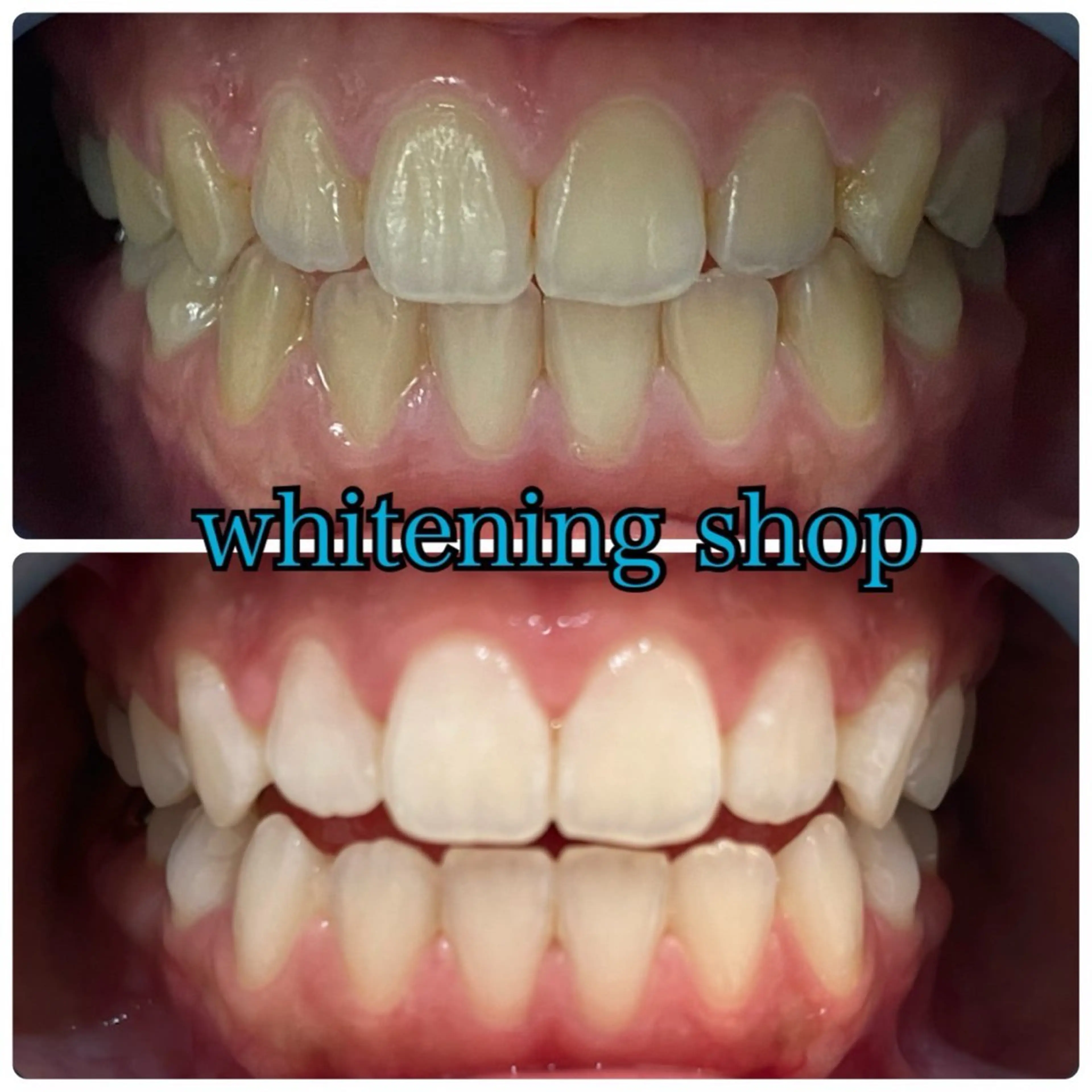 メンズ エステ リラク ホワイトニング ショップ川越店のエステ・リラクイメージ