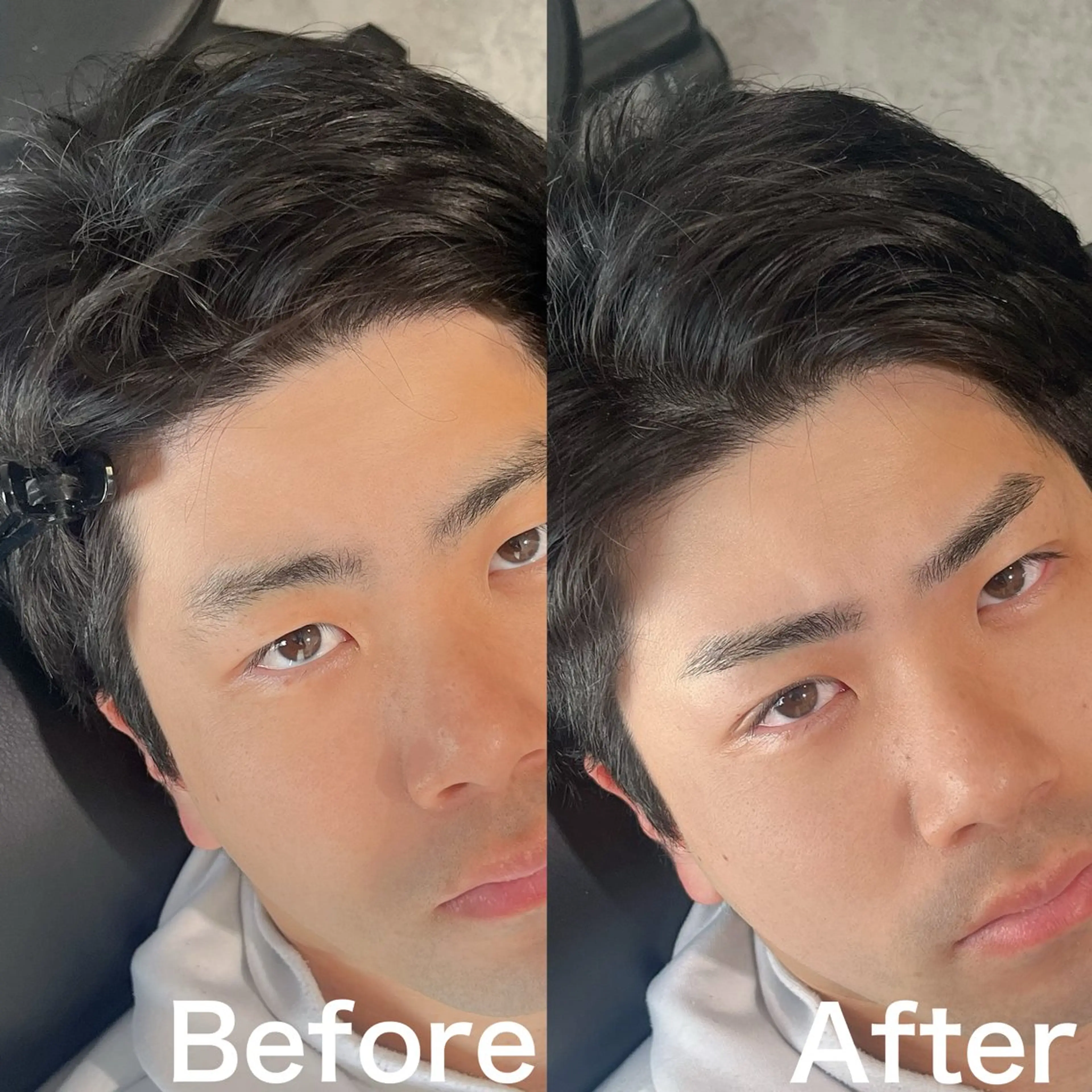 メンズ アイブロウ ワックス脱毛 眉カット その他(アイブロウ) 5日◯ Yusukeの眉毛・アイブロウイメージ