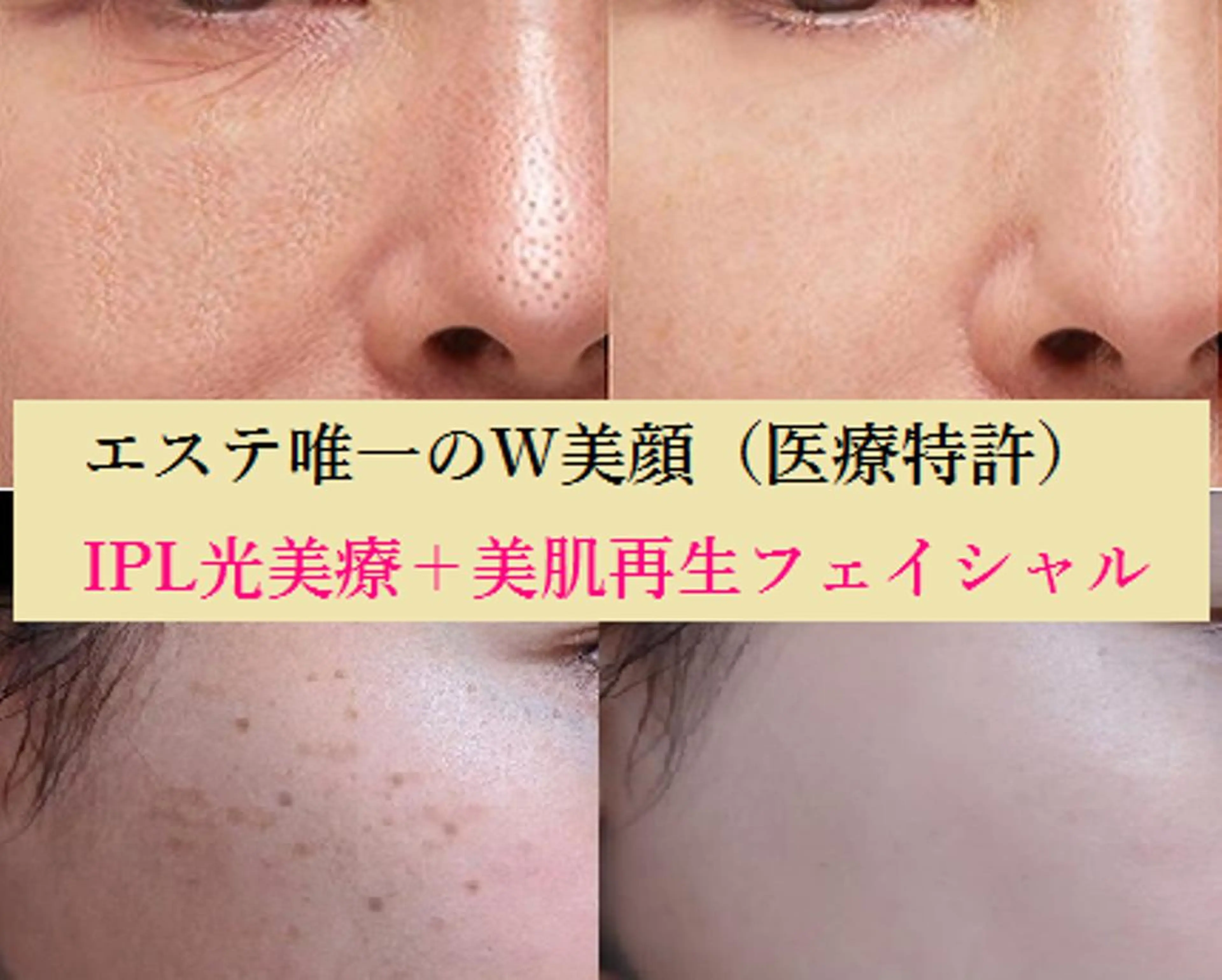 全身脱毛＆VIO脱毛 紹介率№1♪リナ♪のエステ・リラクイメージ