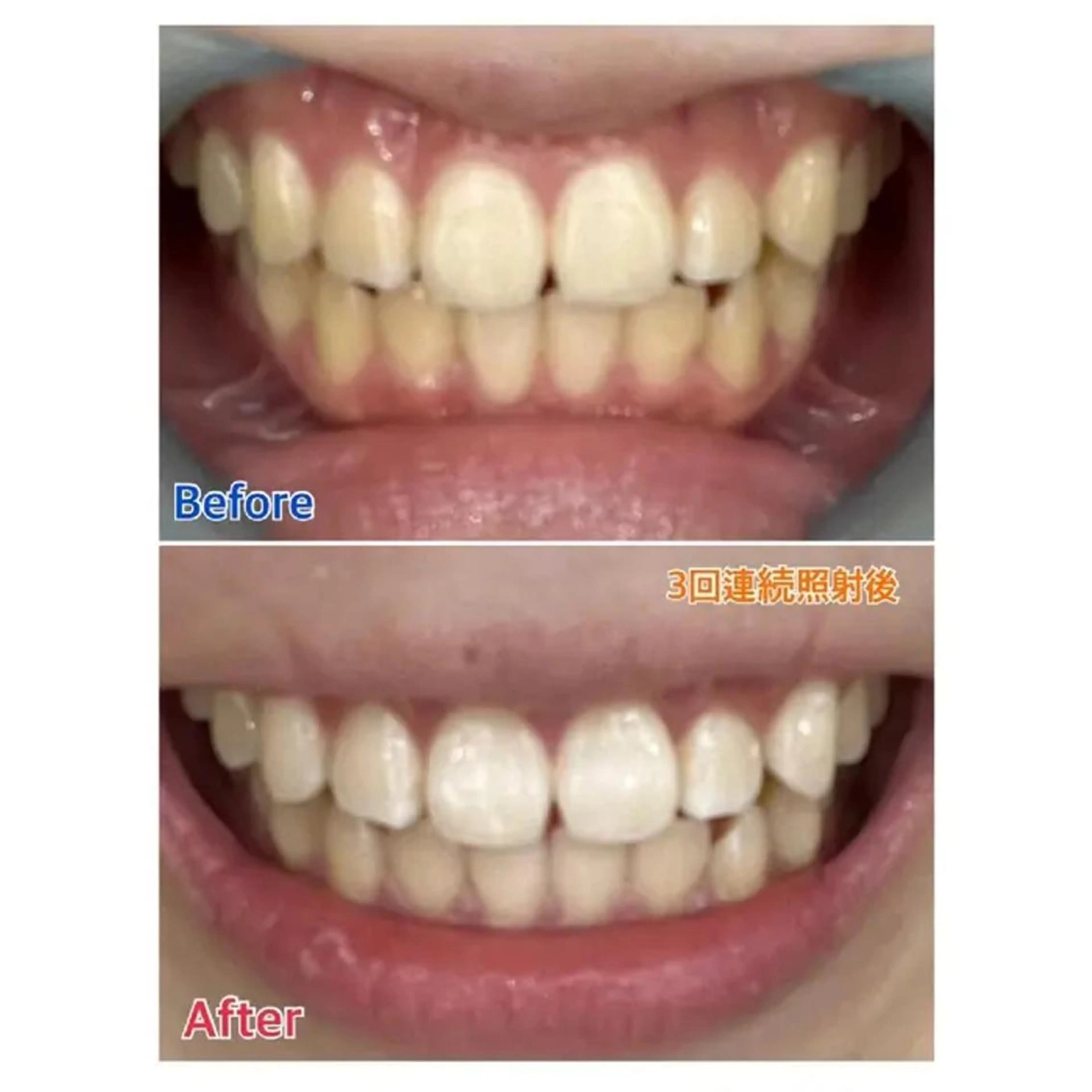 M渋谷 ホワイトニングのエステ・リラクイメージ