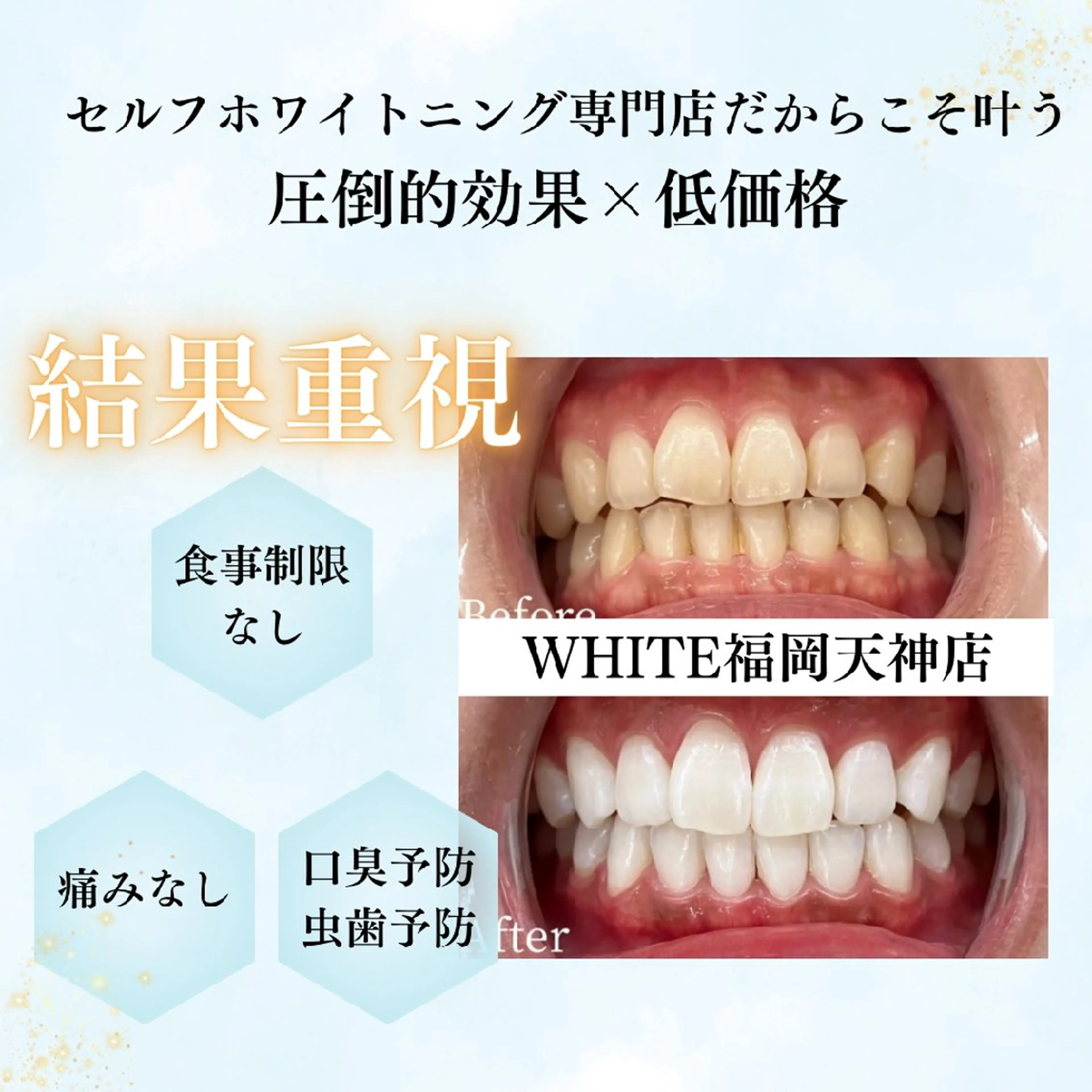 キッズ メンズ エステ リラク セルフホワイトニング WHITE福岡天神店のエステ・リラクイメージ