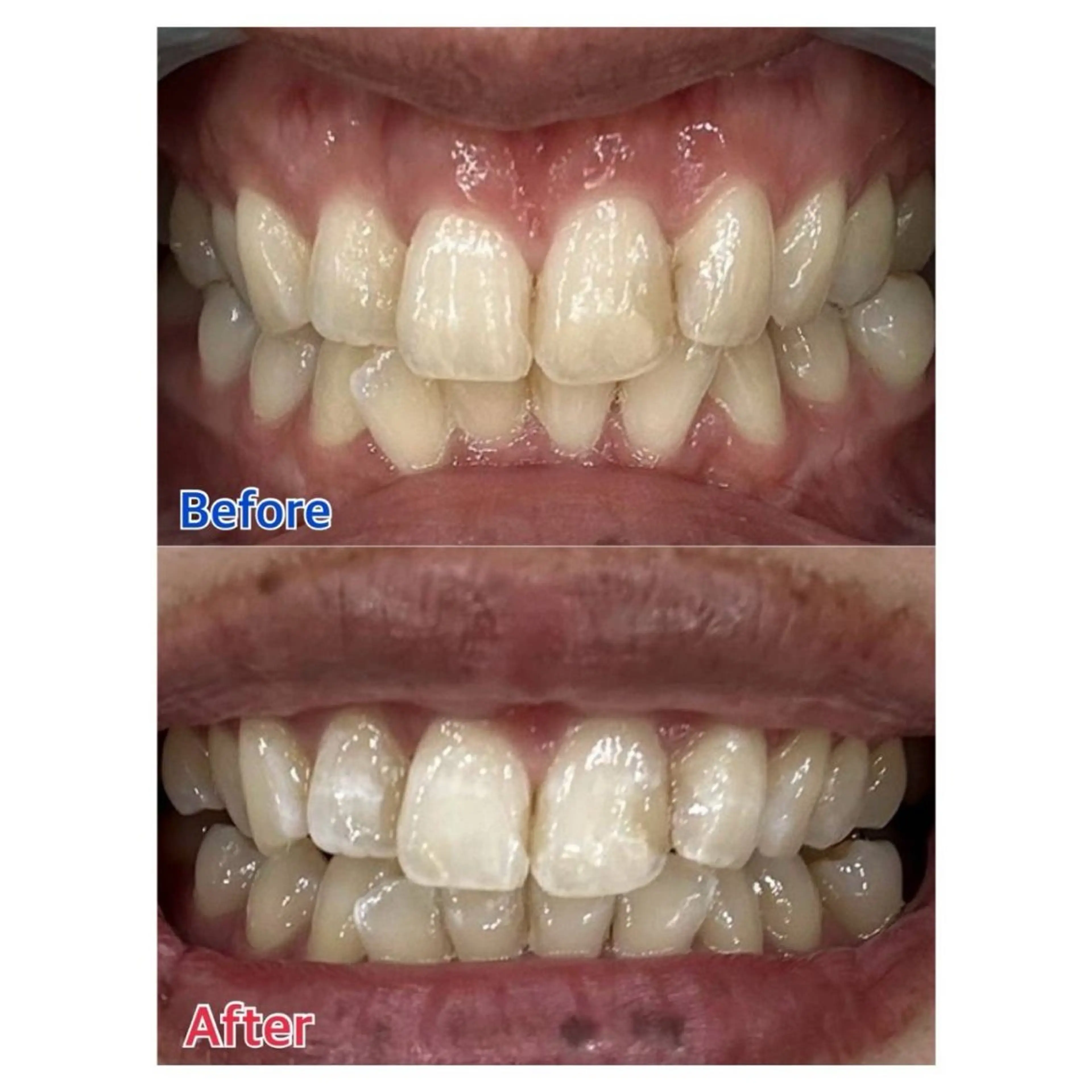 Melty 輝のその他イメージ