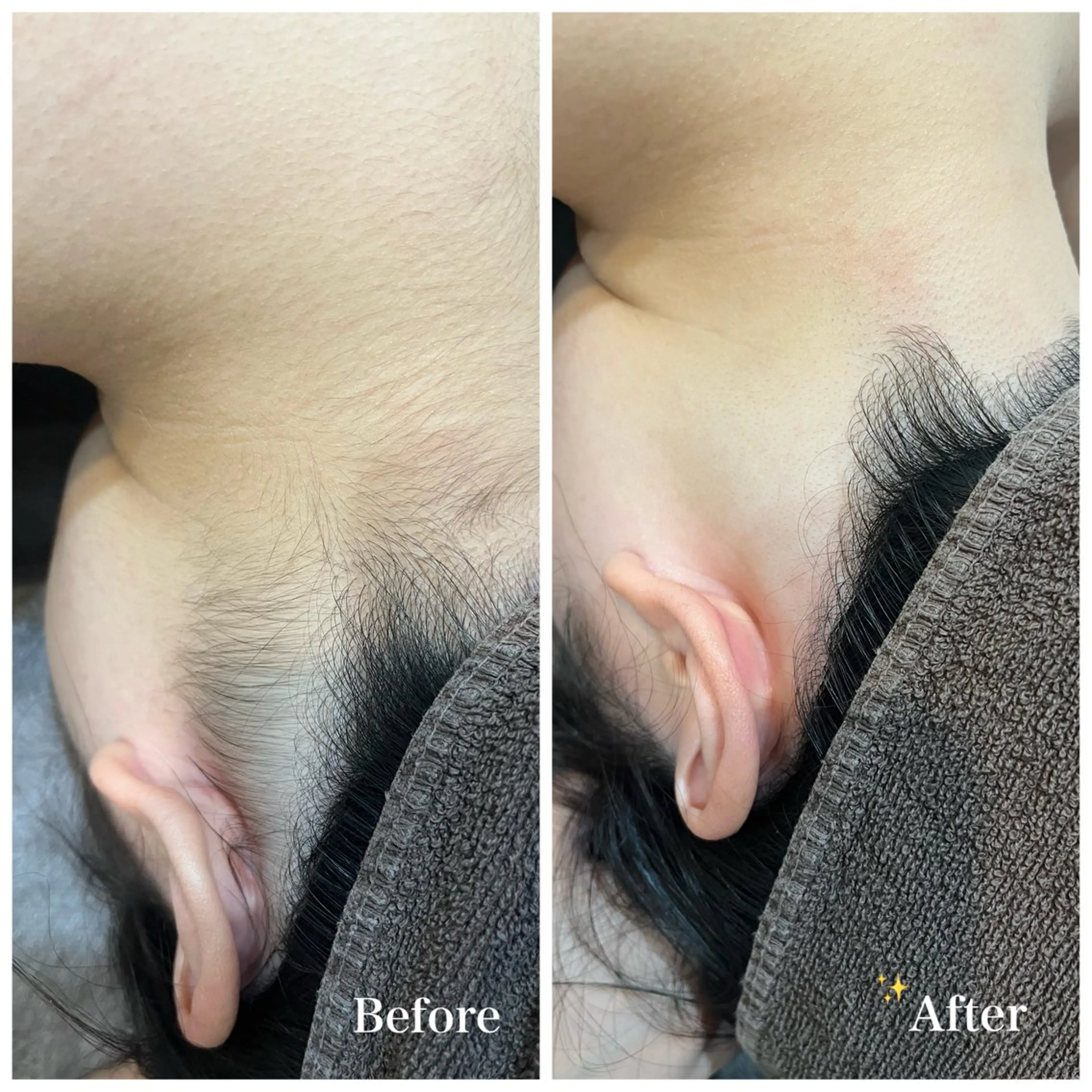 脱毛サロン fam.豊澤柚良のエステ・リラクイメージ