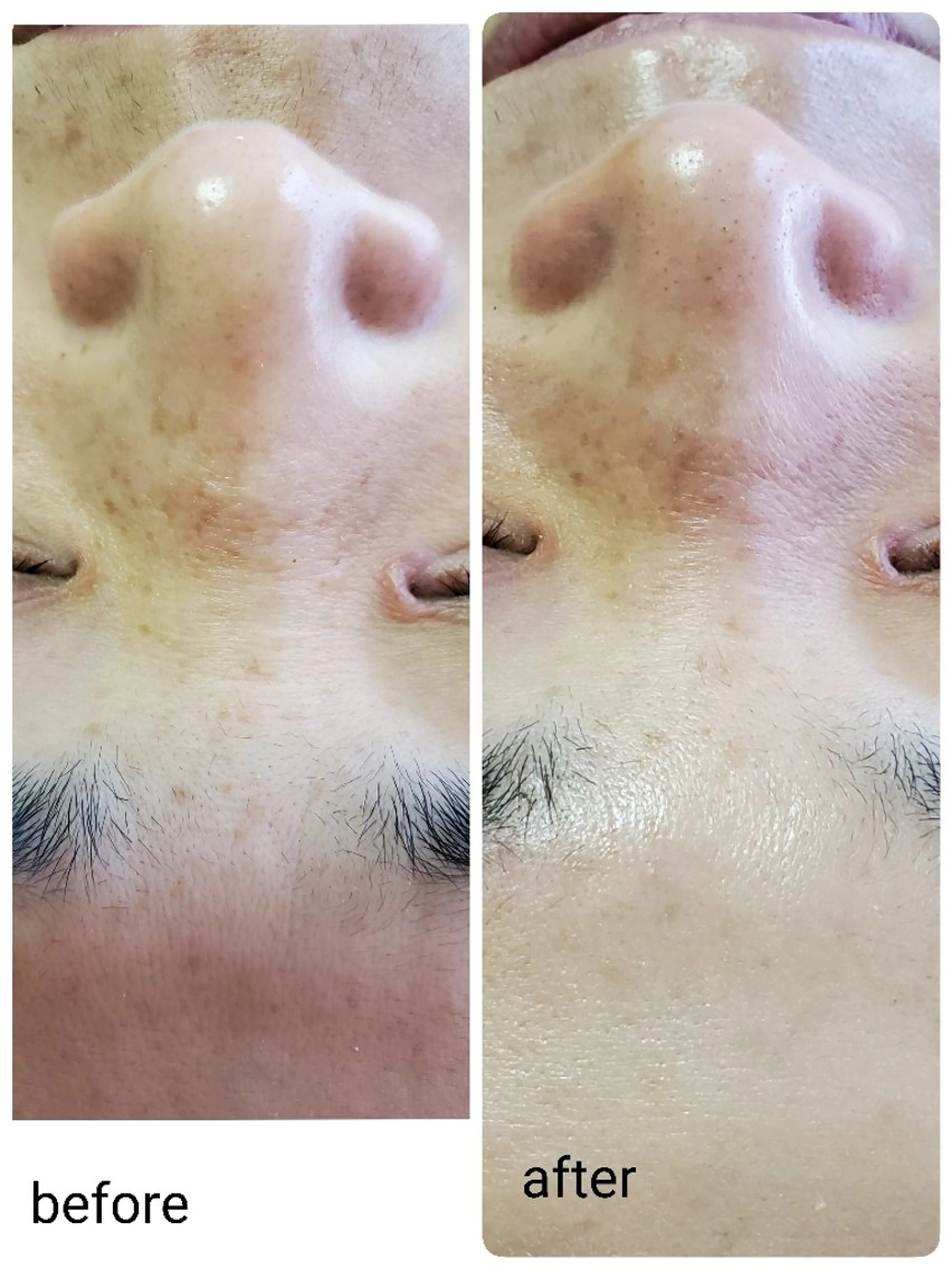 エステ 肌悩み解決サロン ハーブピーリングのエステ・リラクイメージ