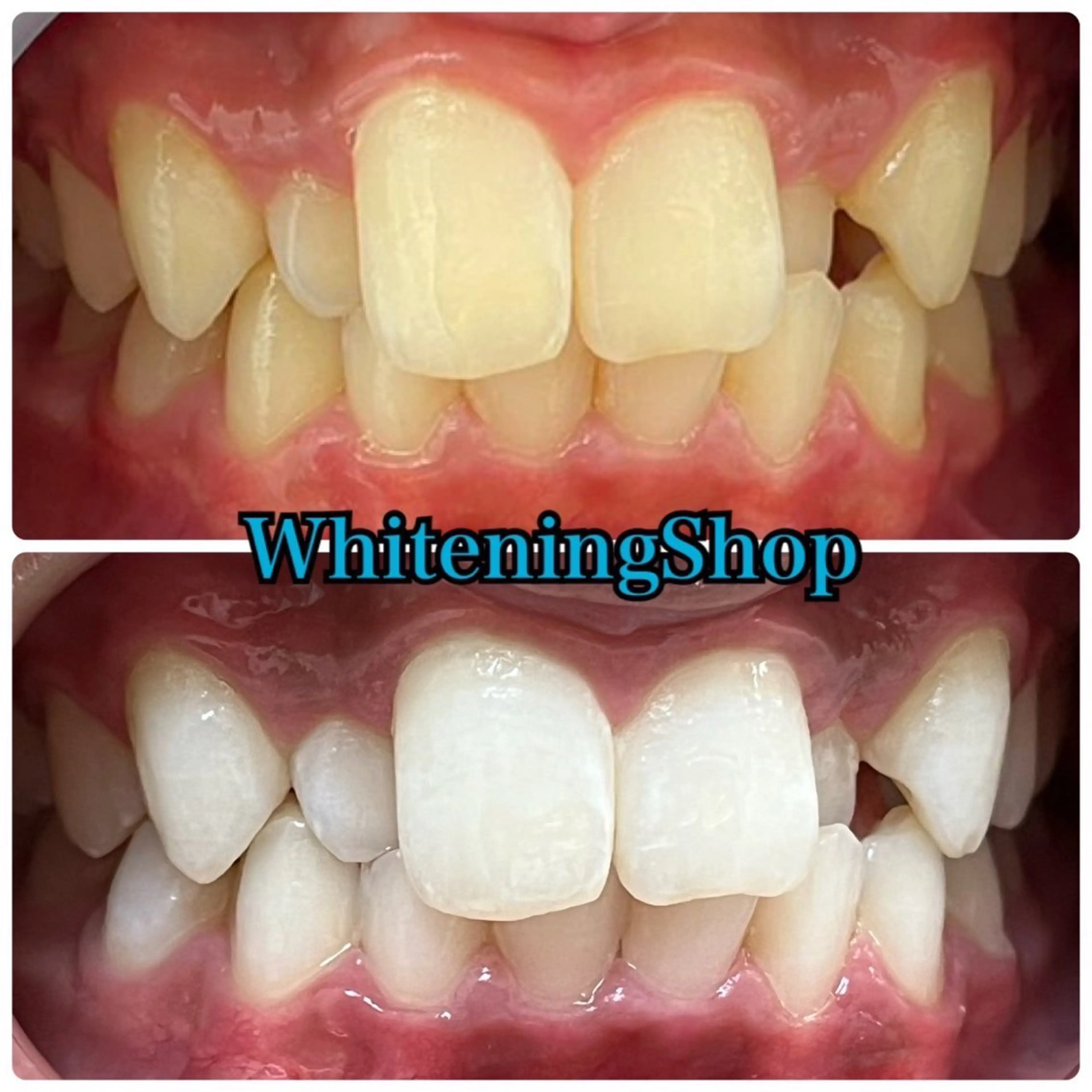 エステ リラク ホワイトニング ショップ吉祥寺店のエステ・リラクイメージ