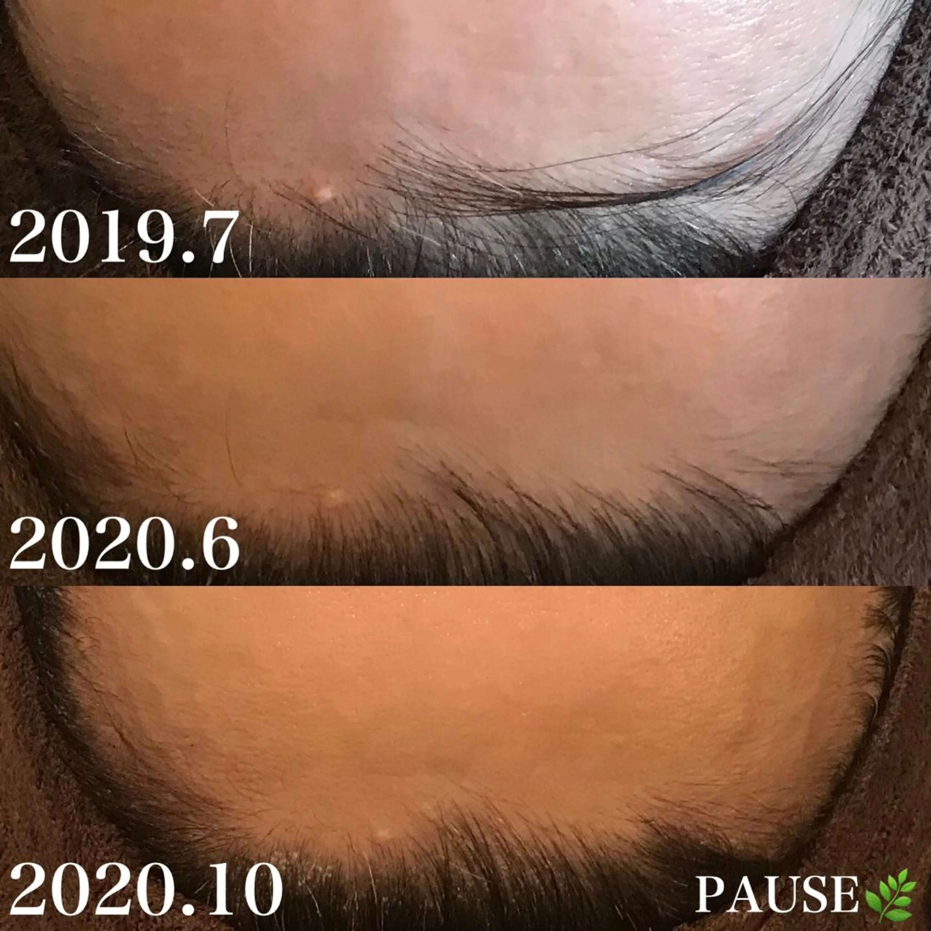 エステ 浜野 恵美のエステ・リラクイメージ