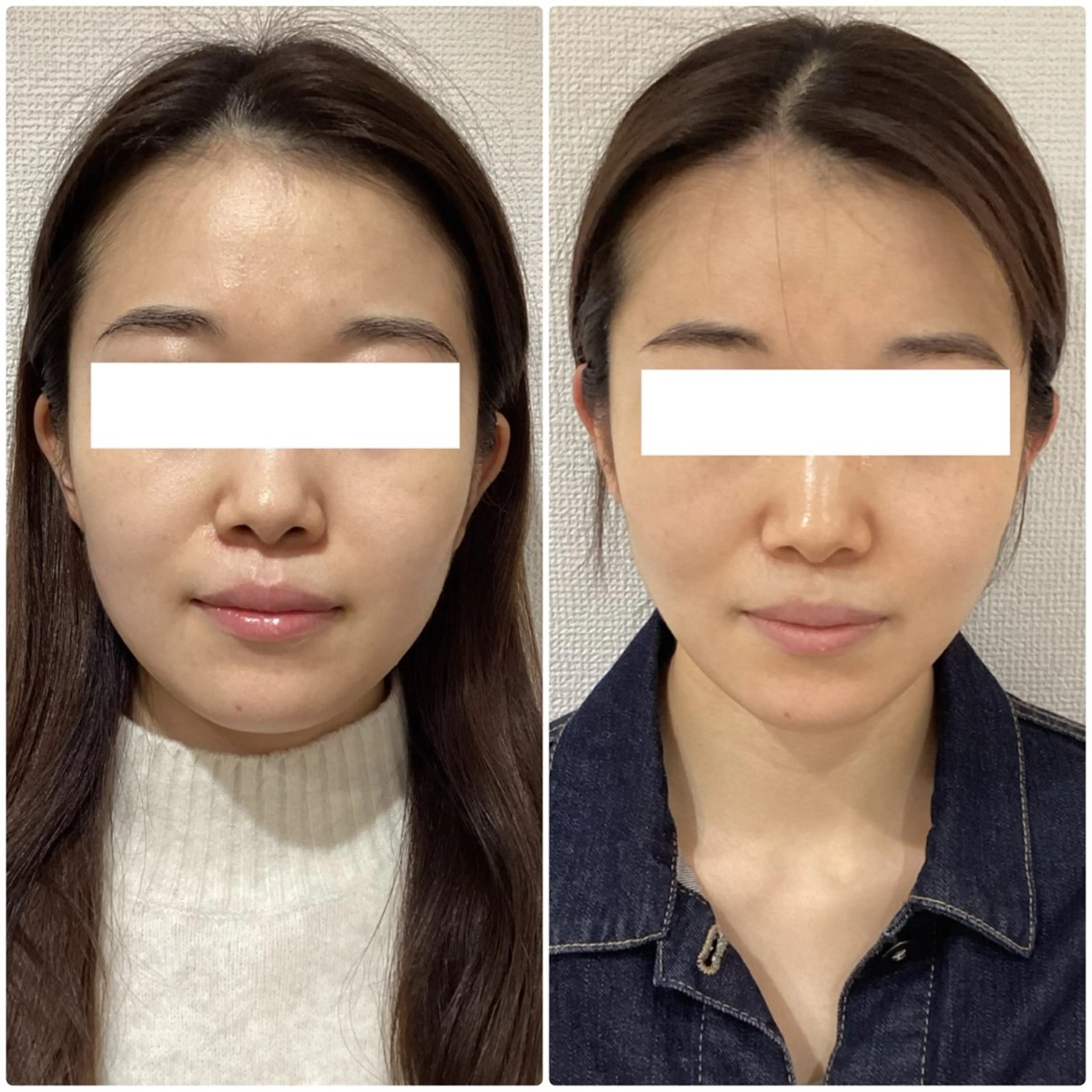 💎小顔ｻﾛﾝ アリリン銀座💎のエステ・リラクイメージ